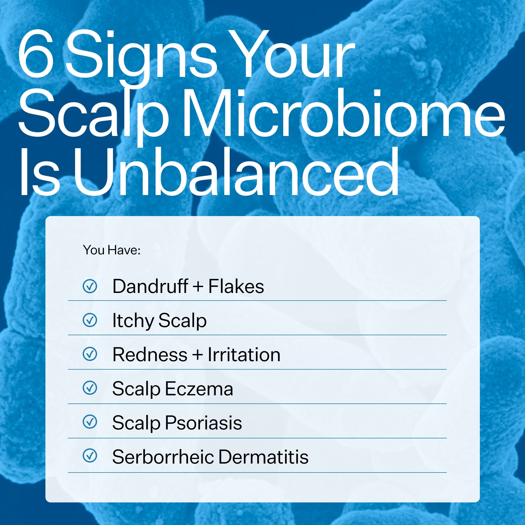 Act + Acre Microbiome Cooling Scalp Serum for Dry & Itchy Scalp - Soothing Treatment for Dandruff & Irritation - Perfect for Daily Hair Care Routine & Scalp Refreshment