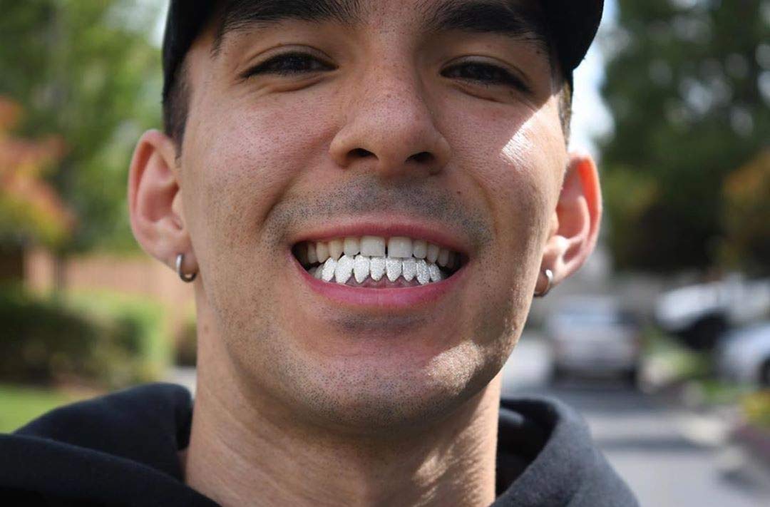 18K Gold Plated Iced Out Simulated Diamond Teeth Grillz - 8 Top & Bottom Dental Grills with Extra Molding Bars | Perfect for Hip Hop Fashion, Rappers, and Special Events
