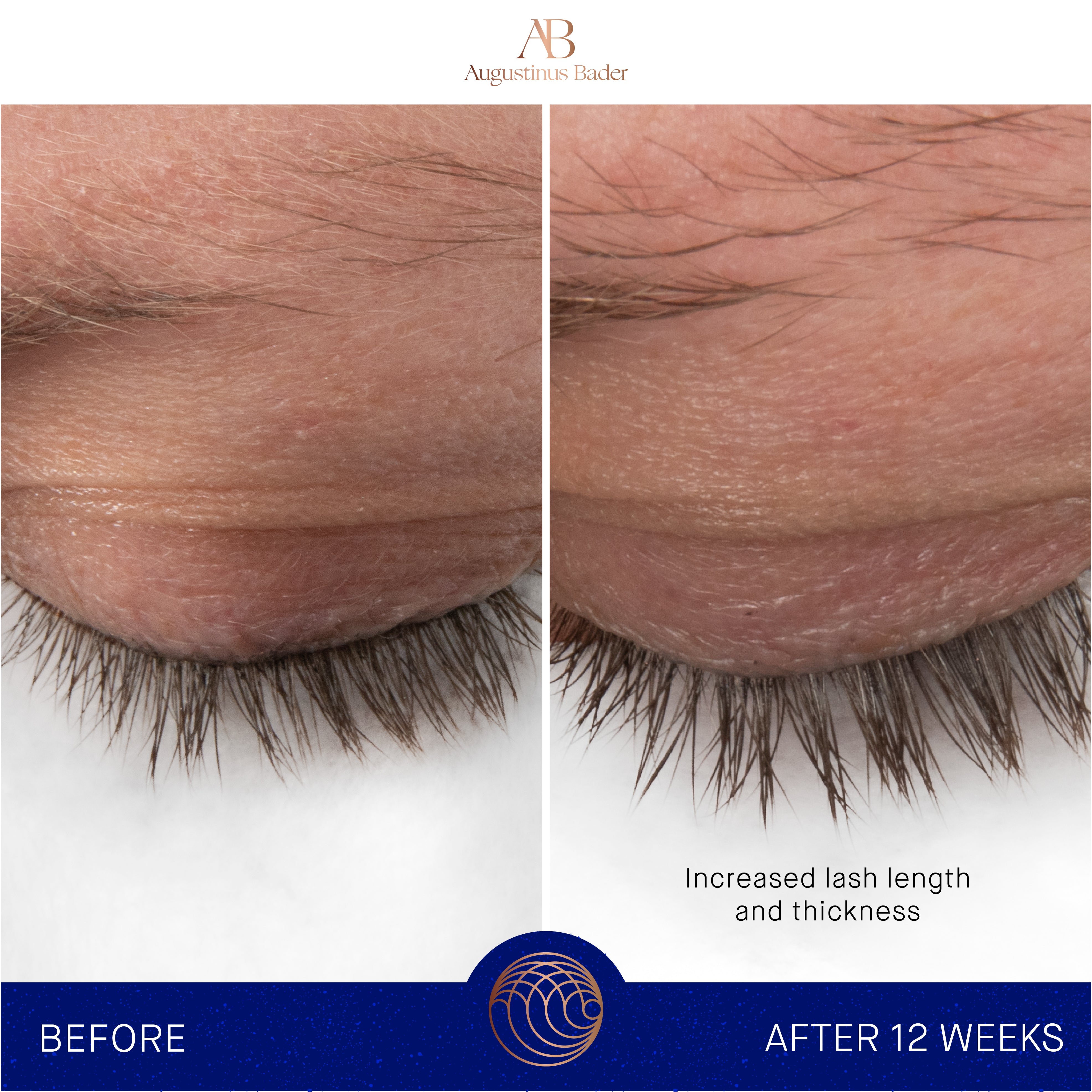 Augustinus Bader The Eyebrow & Lash Enhancing Serum - Growth Treatment for Fuller Brows & Lashes - Perfect for Nighttime Beauty Routine & Special Occasion Prep