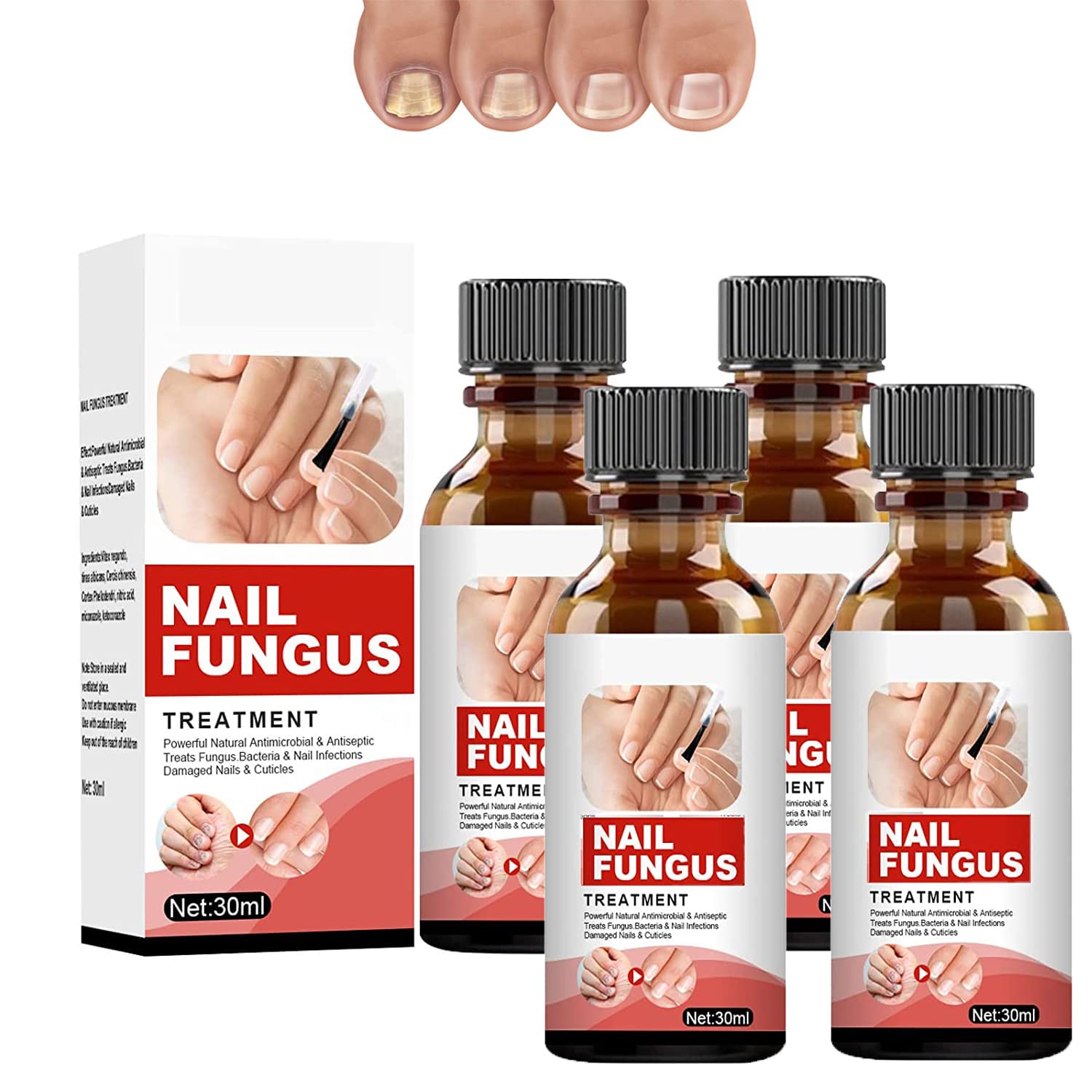 TLOPA Intense Nail Growth Boosting Serum - Nail Strengthener & Cuticle Oil for Stronger, Healthier Nails - Nail Repair Essence with Keratin & Vitamins (4 Pack) - Perfect for Weak, Brittle Nails & Professional Manicures