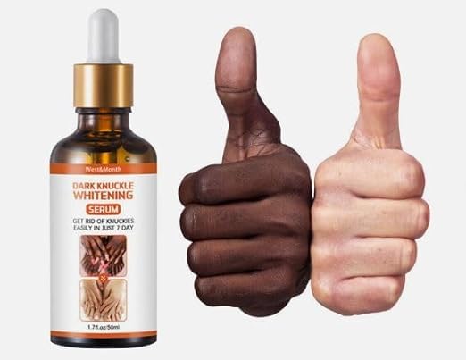 67 Stores Advanced Dark Knuckle Whitening Serum - Skin Tone Corrector for Hands & Elbows | Brightening & Moisturizing Treatment for Women & Men | 30ml | Perfect for Dry, Rough Skin & Hyperpigmentation Care