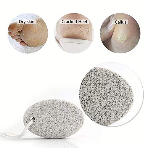 2 Pack Catwings Oval Pumice Stone - Foot Scrubber & Callus Remover for Dry Dead Skin - Pedicure Tool for Soft Smooth Feet at Home or Salon