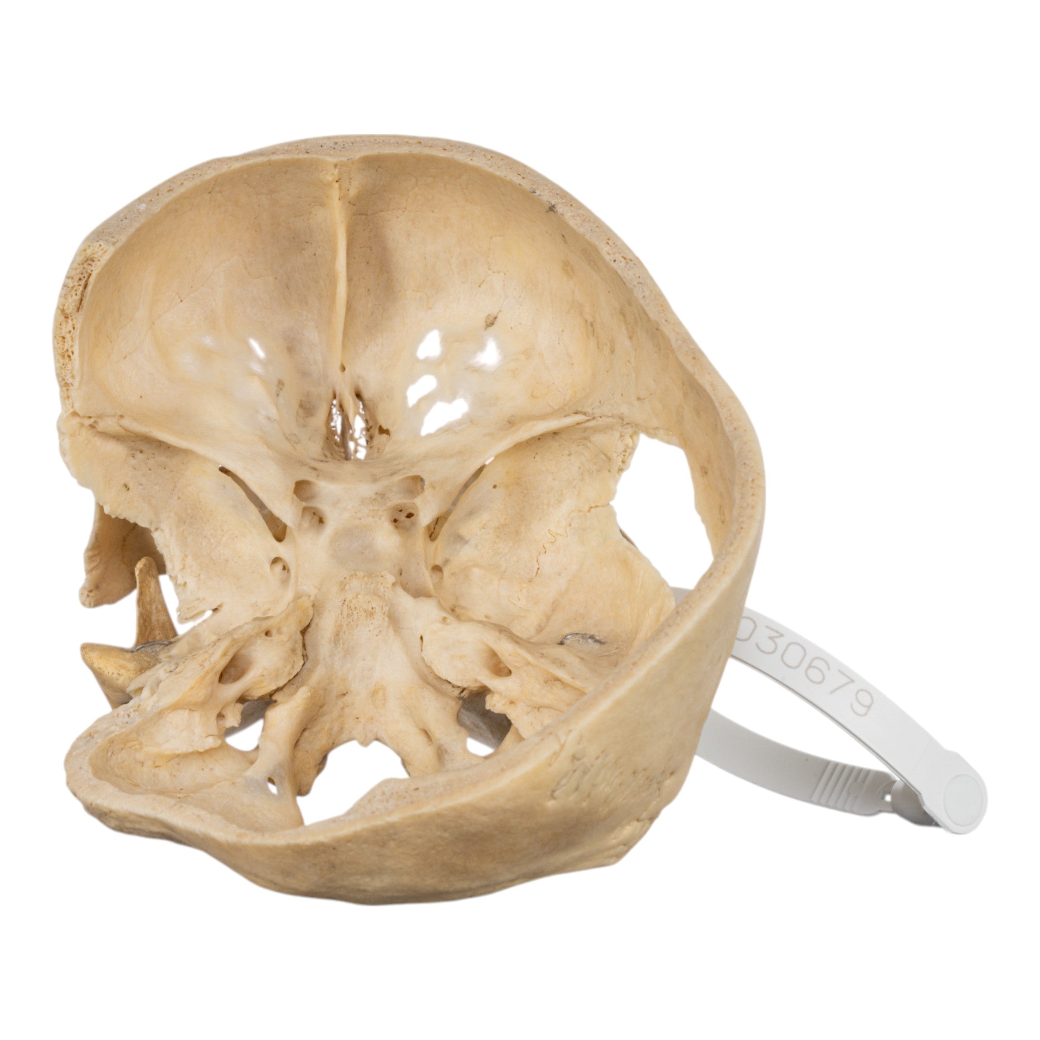 Real Human Skull Partial - Authentic Medical Specimen for Anatomy Study, Halloween Decor & Gothic Collectibles