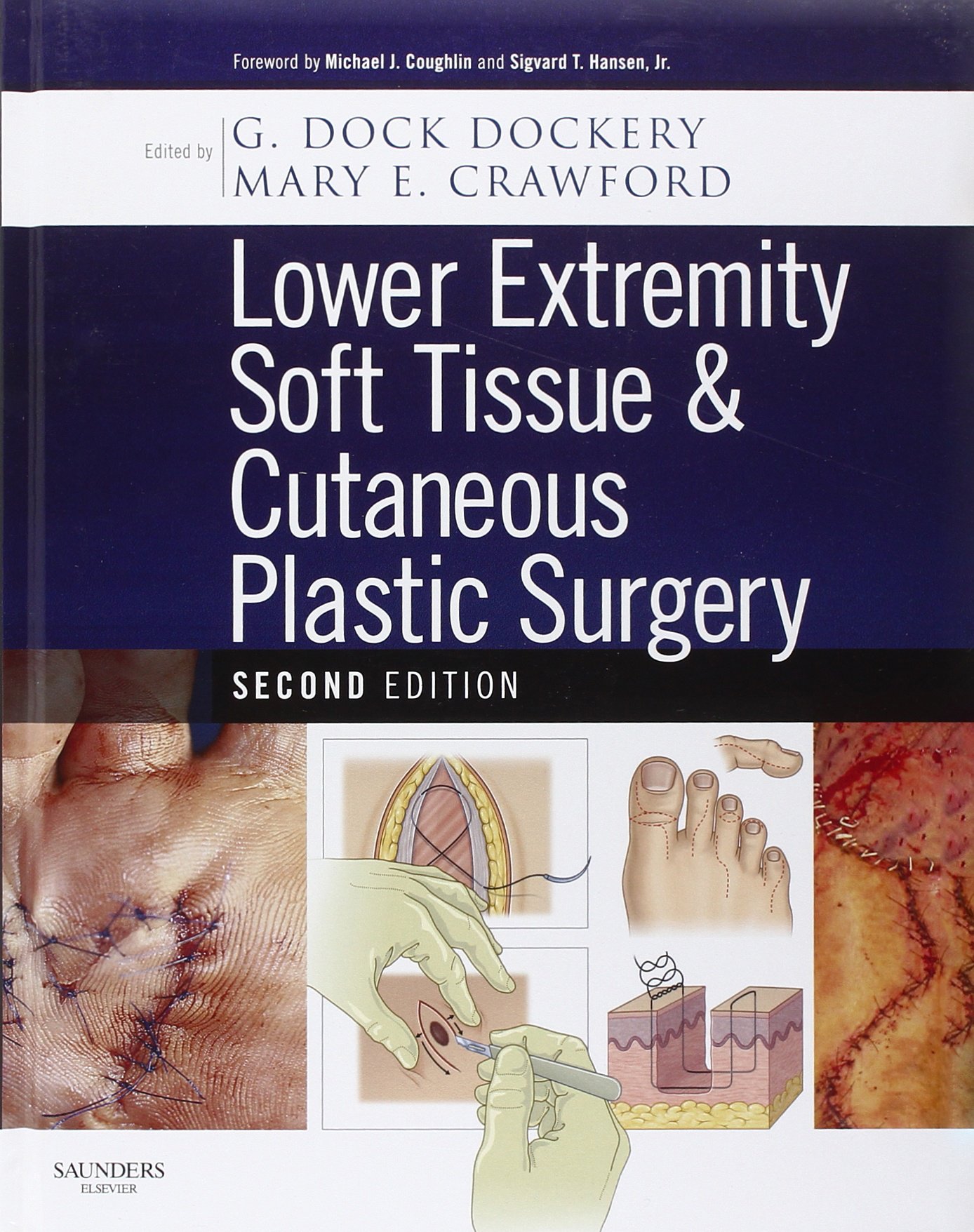 Lower Extremity Soft Tissue & Cutaneous Plastic Surgery - Advanced Wound Care & Skin Reconstruction Solutions for Foot & Leg Injuries | Ideal for Post-Trauma Recovery, Diabetic Ulcers & Cosmetic Procedures