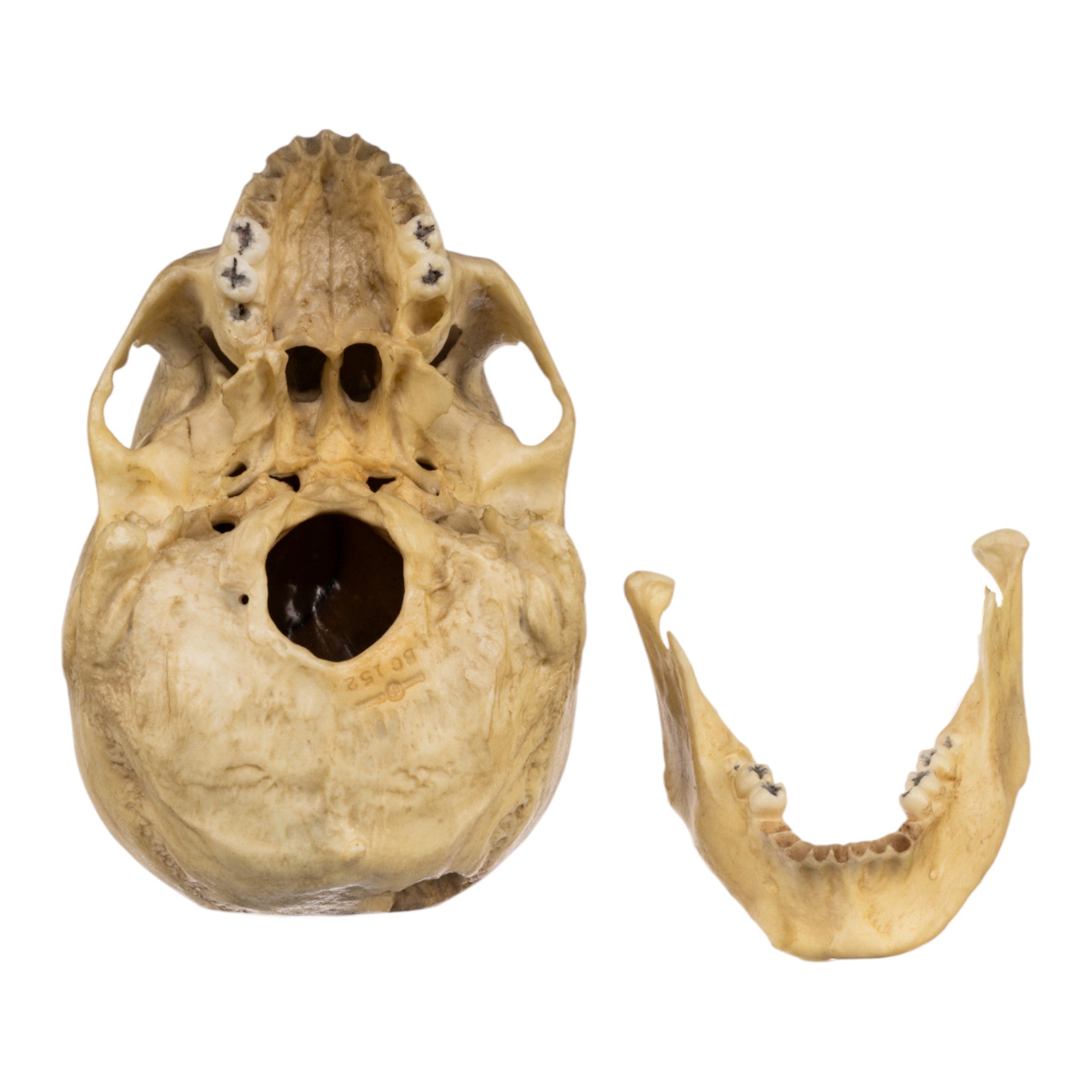 Realistic Replica Human Male Skull with 32 Caliber Gunshot Wound - Perfect for Medical Training, Forensic Studies, and Halloween Decorations