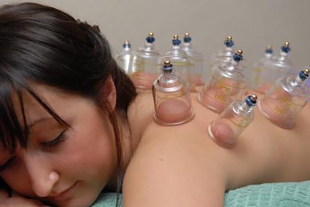 Professional Electric Automatic Cupping Therapy Set - Complete Kit for Pain Relief & Muscle Recovery | Home Use, Spa, Massage Therapy