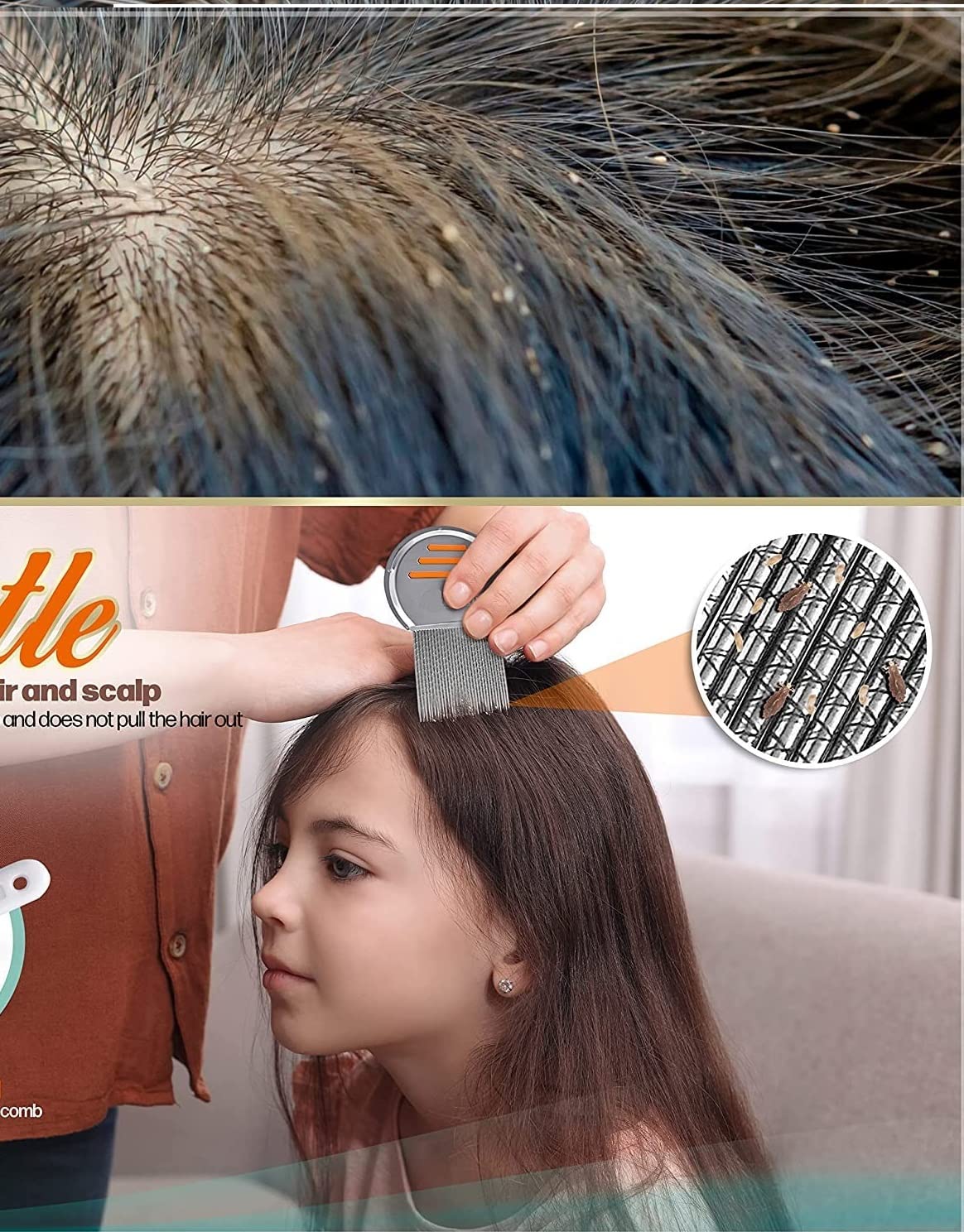 Professional Stainless Steel Lice Comb for Head Lice Treatment - 2pc Terminator Louse & Nit Comb Set - Effectively Removes Nits & Lice Eggs - Perfect for Home, School & Travel Use