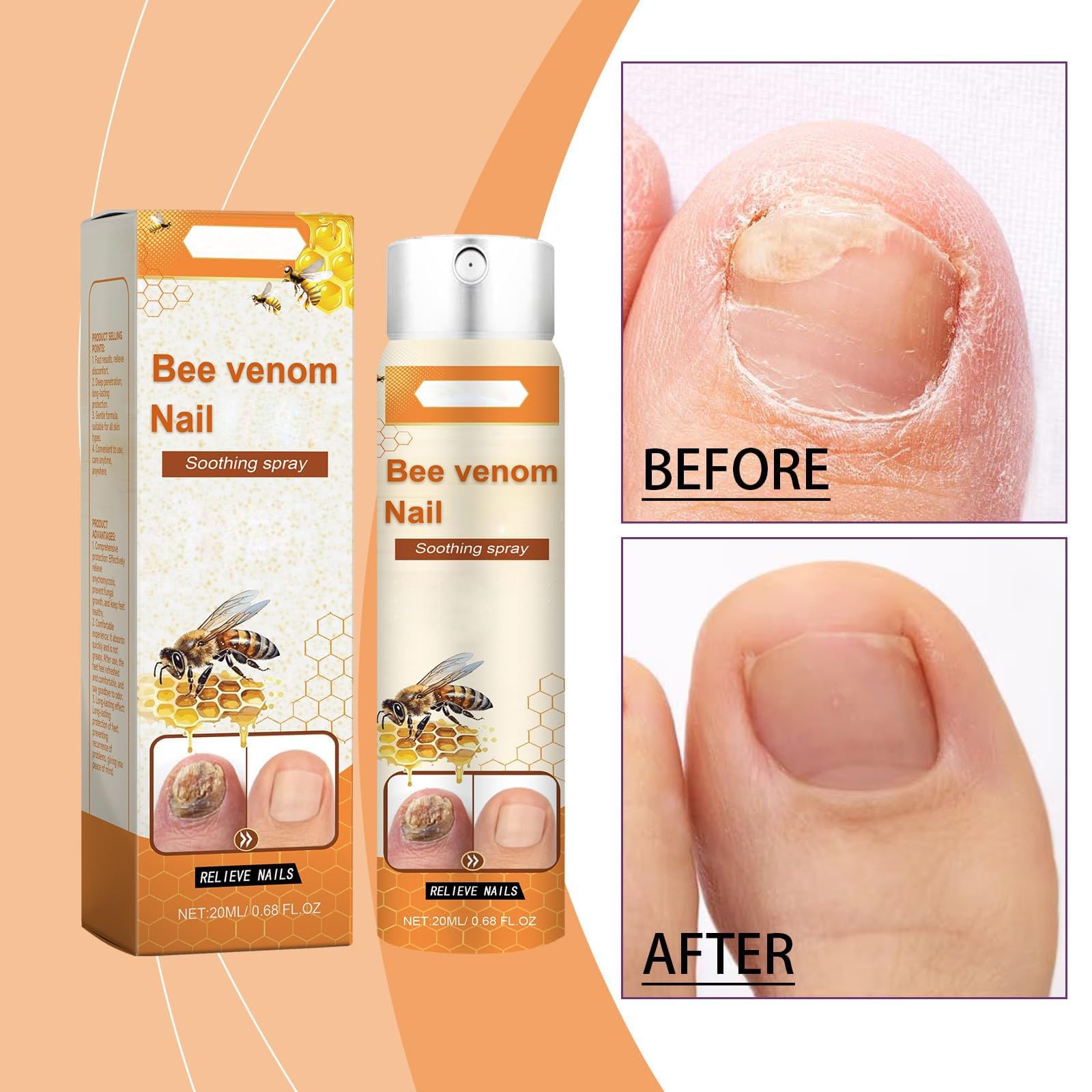 Bee Venom Nail Fungus Treatment Spray - Fast-Acting Toenail Fungus Solution with Natural Bee Venom Serum | Promotes Nail Growth & Repair | Ideal for Athletes, Swimmers & Pedicure Lovers