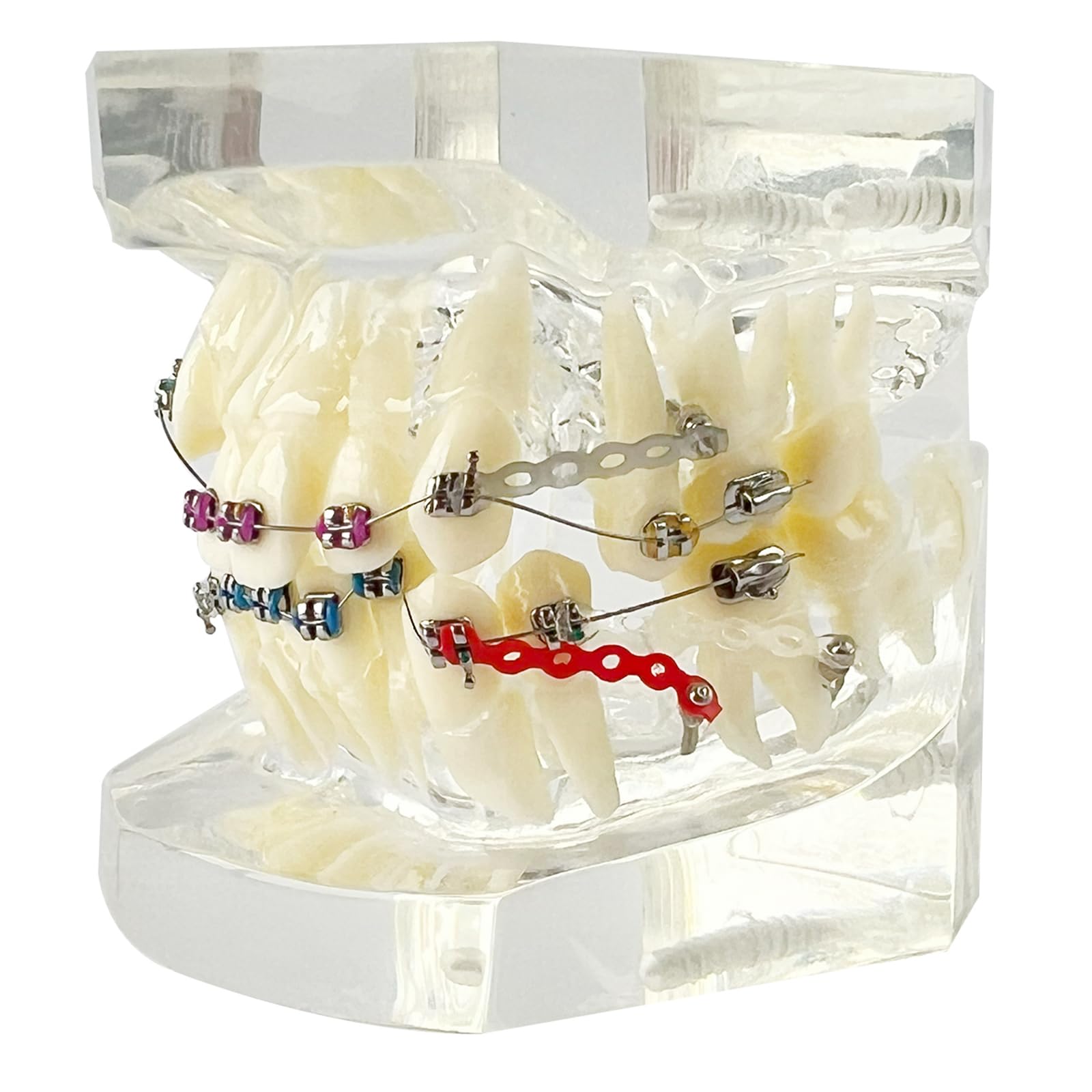 Orthodontic Demonstration Model with Stainless Steel Brackets & Colorful Ligatures - Teeth Alignment Correction Display on Clear Acrylic Base - Perfect for Dental Education, Training & Office Demonstration (Dental School, Clinic & Patient Education Tool)