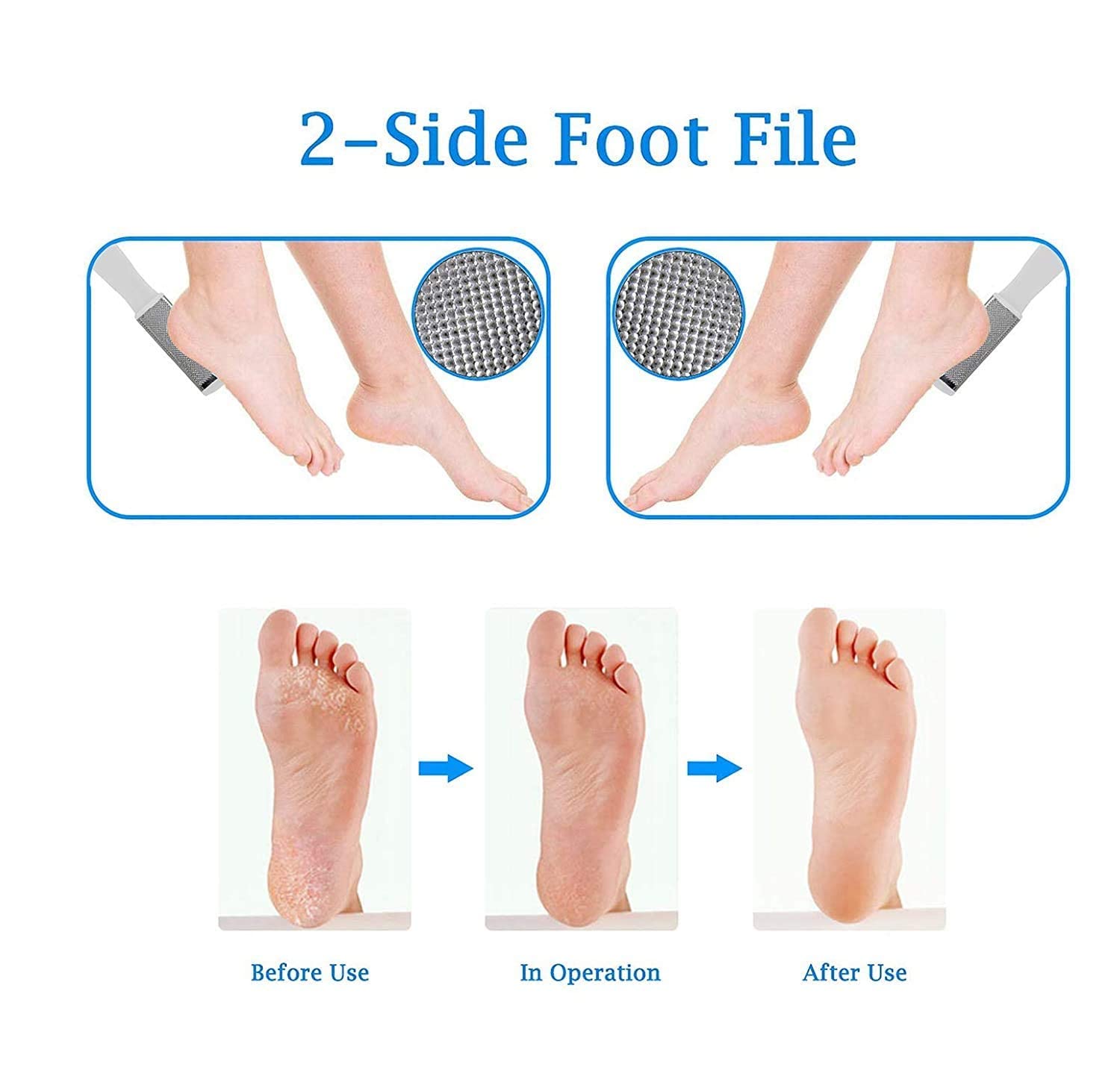 Pelo Steel Foot Exfoliating Scrubber & Cleaner - 2 Pack | Heavy Duty Callus Remover for Dry Cracked Feet | Perfect for Pedicures, Home Spa & Foot Care Routine