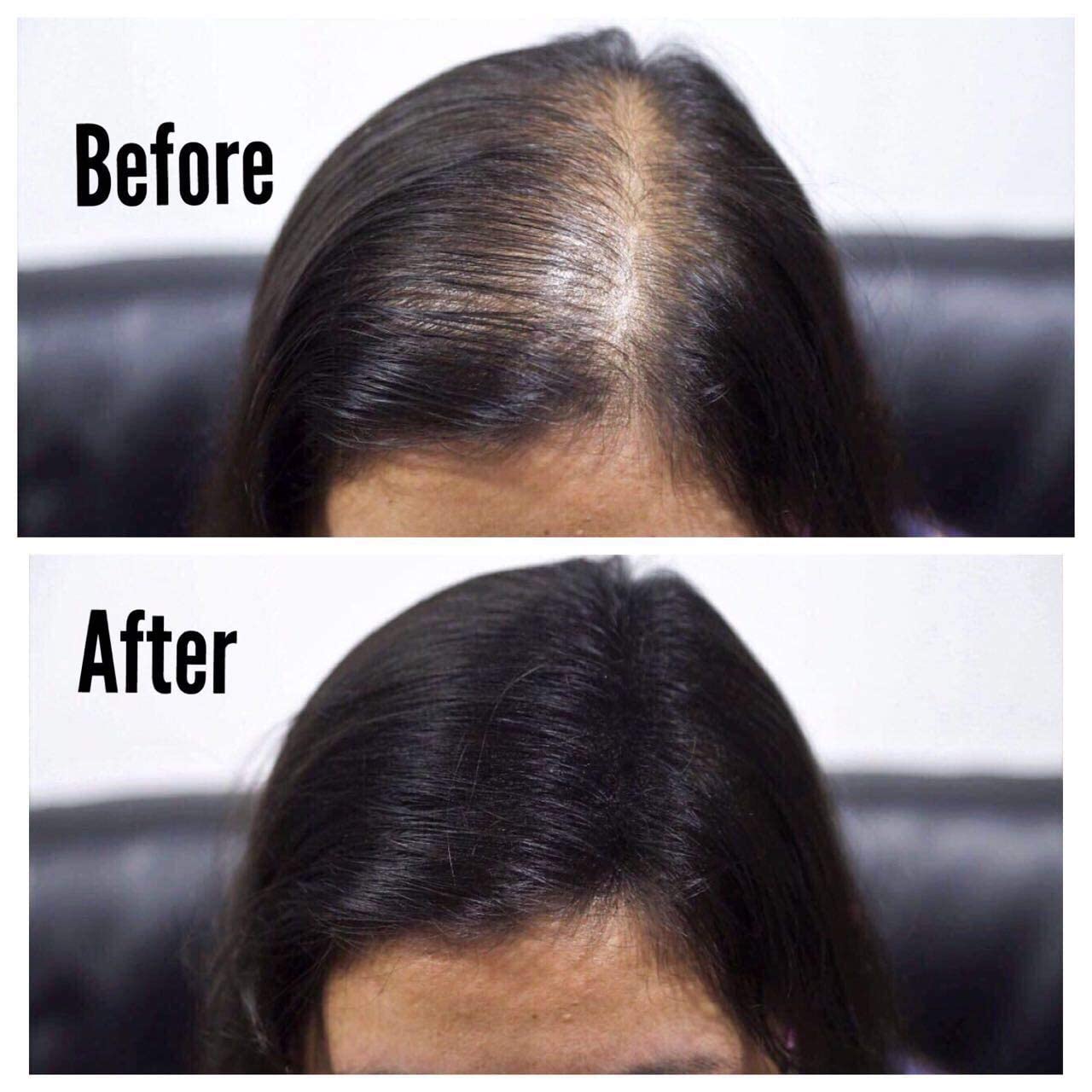 Hair Building Fiber for Thinning Hair - Topik Cabok Refill Pack (Black, 25g x 2) | Instant Hair Loss Concealer for Men & Women | Perfect for Daily Use, Special Occasions & Confidence Boosting