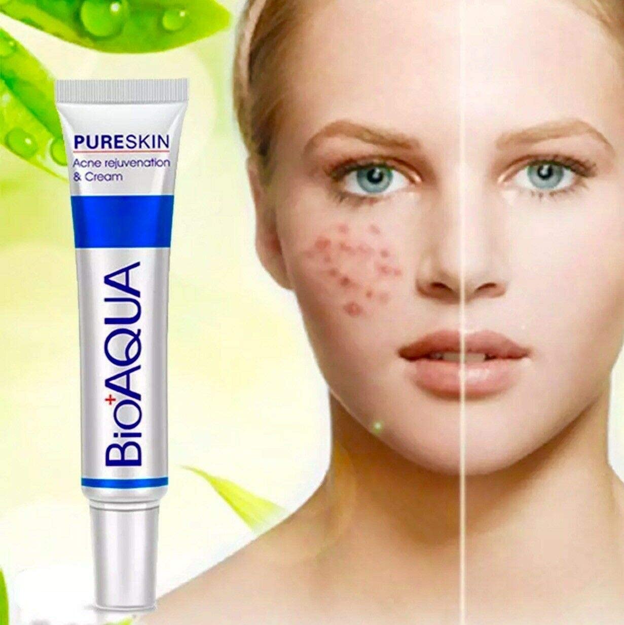 MAPPERZ AquaBioaqua Acne Treatment Cream - Pimple Scar Removal, Oil Control & Pore Minimizer for Clear Skin | 30g Face Care for Teens & Adults | Perfect for Daily Skincare Routine & Post-Acne Recovery