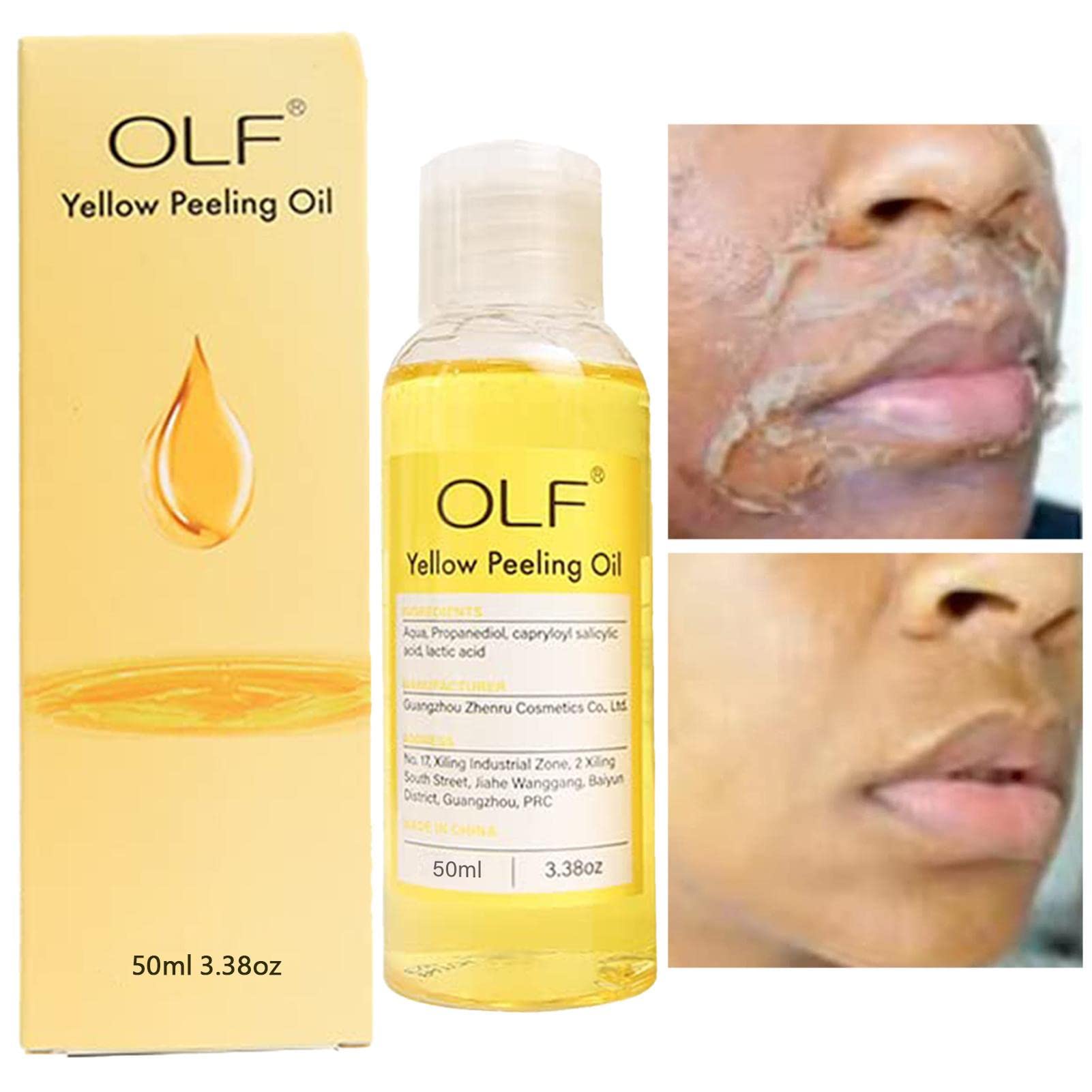 Extra Strength Yellow Peeling Oil for Dark Skin - 50ml Body & Face Exfoliator | Natural Dead Skin Lightening Treatment | The Ordinary Peeling Solution Alternative | Perfect for Post-Sun Care & Pre-Makeup Prep