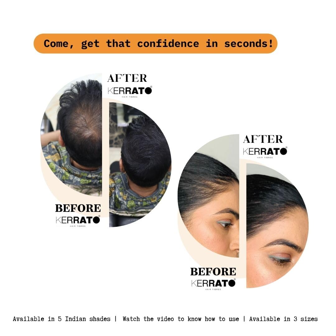 Kerrato Natural Hair Fibres for Thinning Hair - Light Brown 28g | Instant Hair Loss Concealer in 10 Seconds | Hair Thickening Fibers for Men & Women | Perfect for Daily Use, Special Occasions & Confidence Boosting