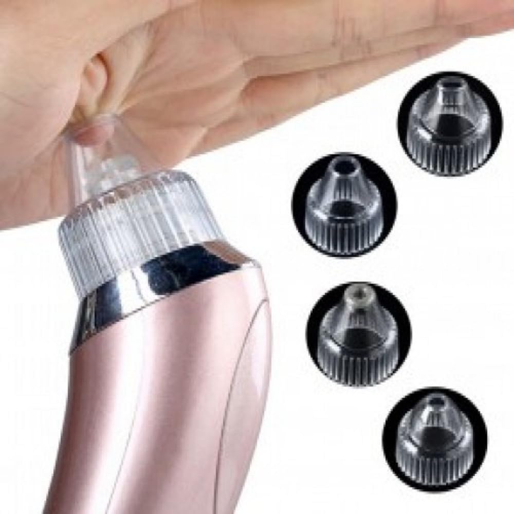 Twiclo Blackhead Remover Vacuum Kit - Professional Acne Treatment & Pore Cleaner for Beautiful Skin | 1 PC | Perfect for Daily Skincare Routine & Spa Treatments