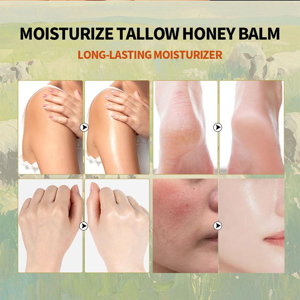 Organic Grass-Fed Beef Tallow Collagen Face Cream with Manuka Honey & Beeswax - 7-in-1 Moisturizing Balm for Dry Skin, Anti-Aging & Night Care - Whipped Tallow Honey Skin Treatment for Face, Lips & Hands