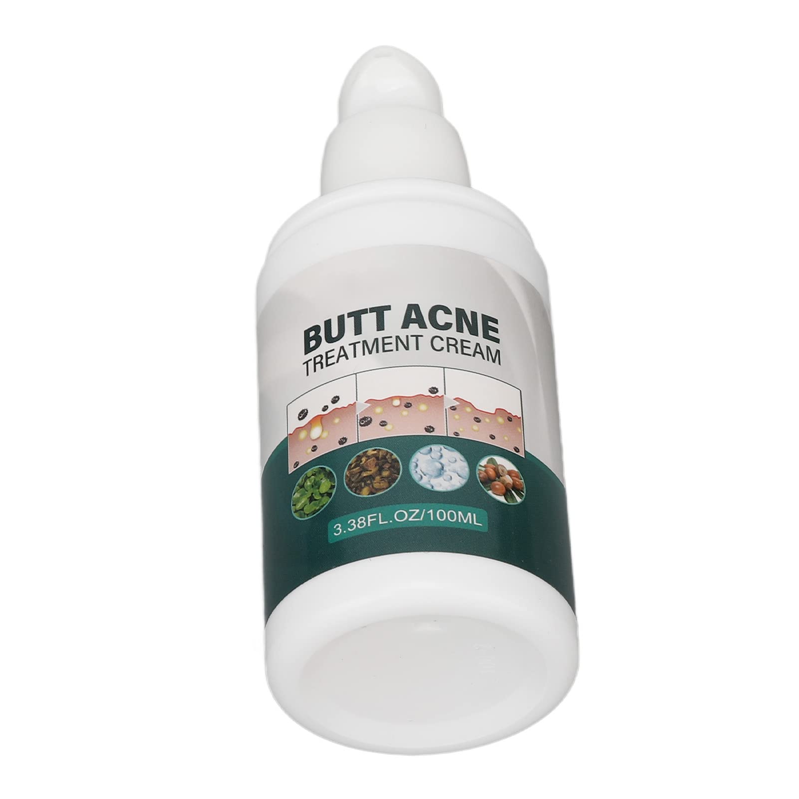 Best Buttock Pimple Treatment Cream - Acne Cleansing & Skin Moisturizing Repair for Thigh & Butt Area | Prevent & Soothe Breakouts for Smooth Skin | Perfect for Post-Workout, Travel & Daily Care