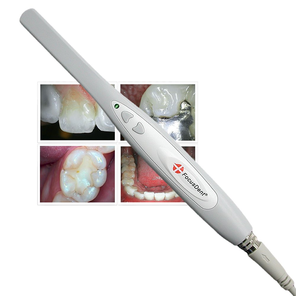 MD740 Dental Intraoral Camera with USB Connection - 6 LED Lights & 1.3MP HD Imaging - Includes Dental Software for Oral Examinations & Patient Education