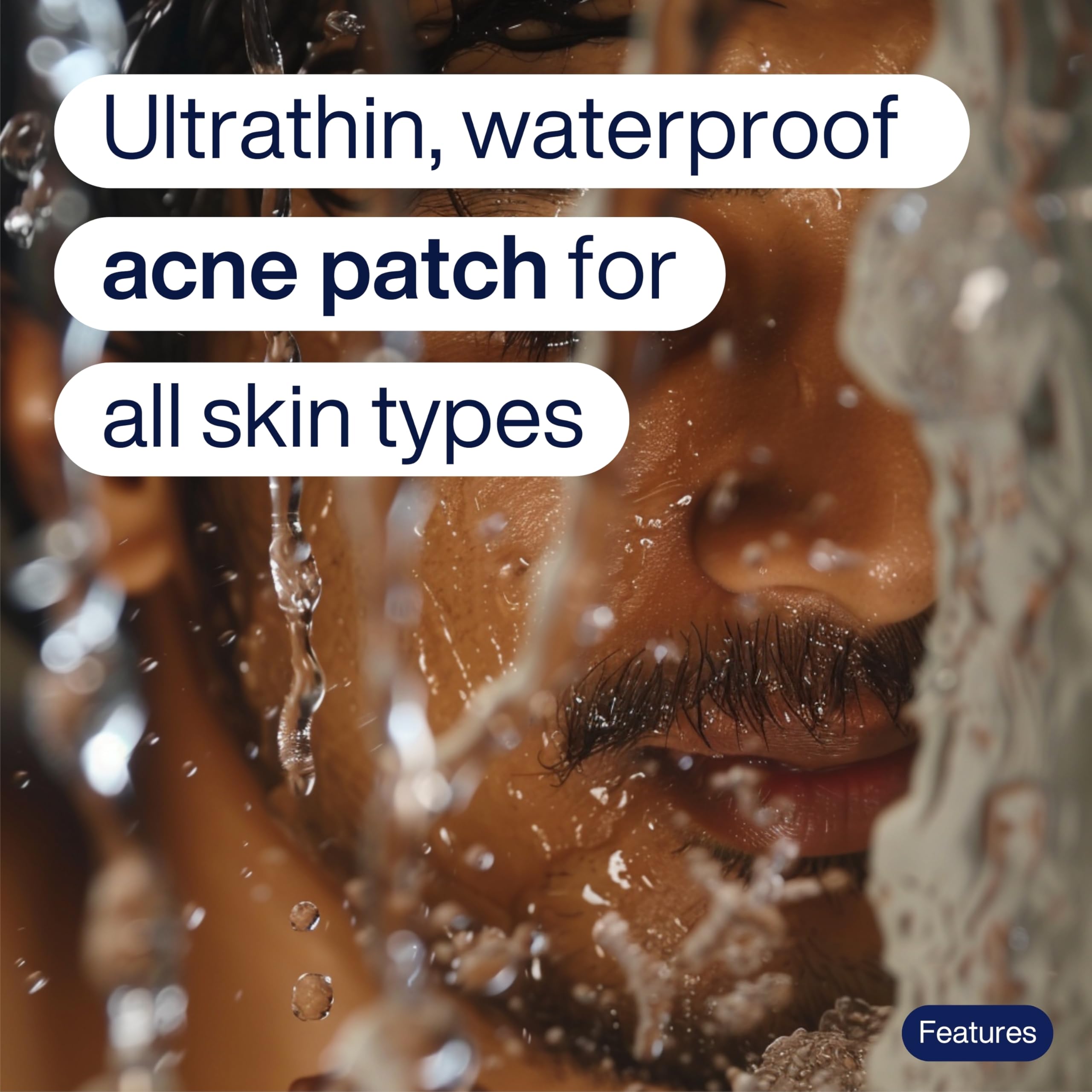 TOTAL ROUTINE Acne Recovery Patch - 72 Count Hydrocolloid Pimple Patches for Overnight Acne Treatment | Waterproof, Invisible Spot Cover for Active Breakouts | Reduces Pimples, Excess Oil & Blemishes | Perfect for Face, Back & Body Care Routine
