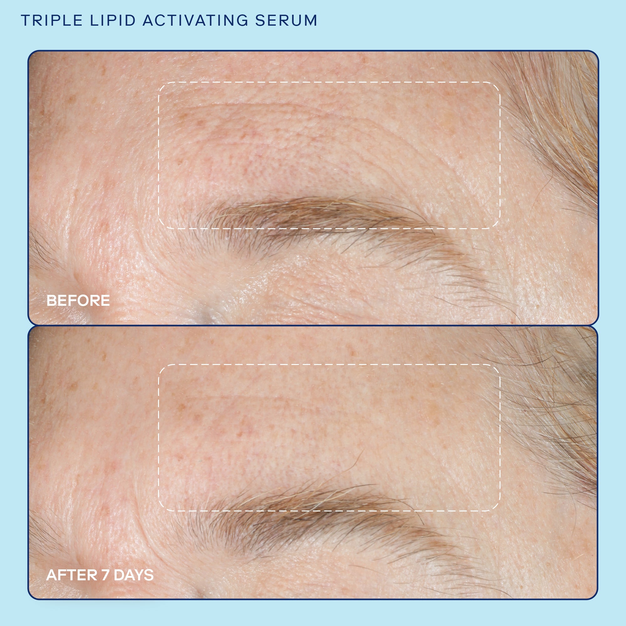 Barrier+ Triple Lipid Activating Serum for Face - Anti-Aging Moisturizing Treatment with Ceramides | Day & Night Hydration for Dry, Sensitive Skin