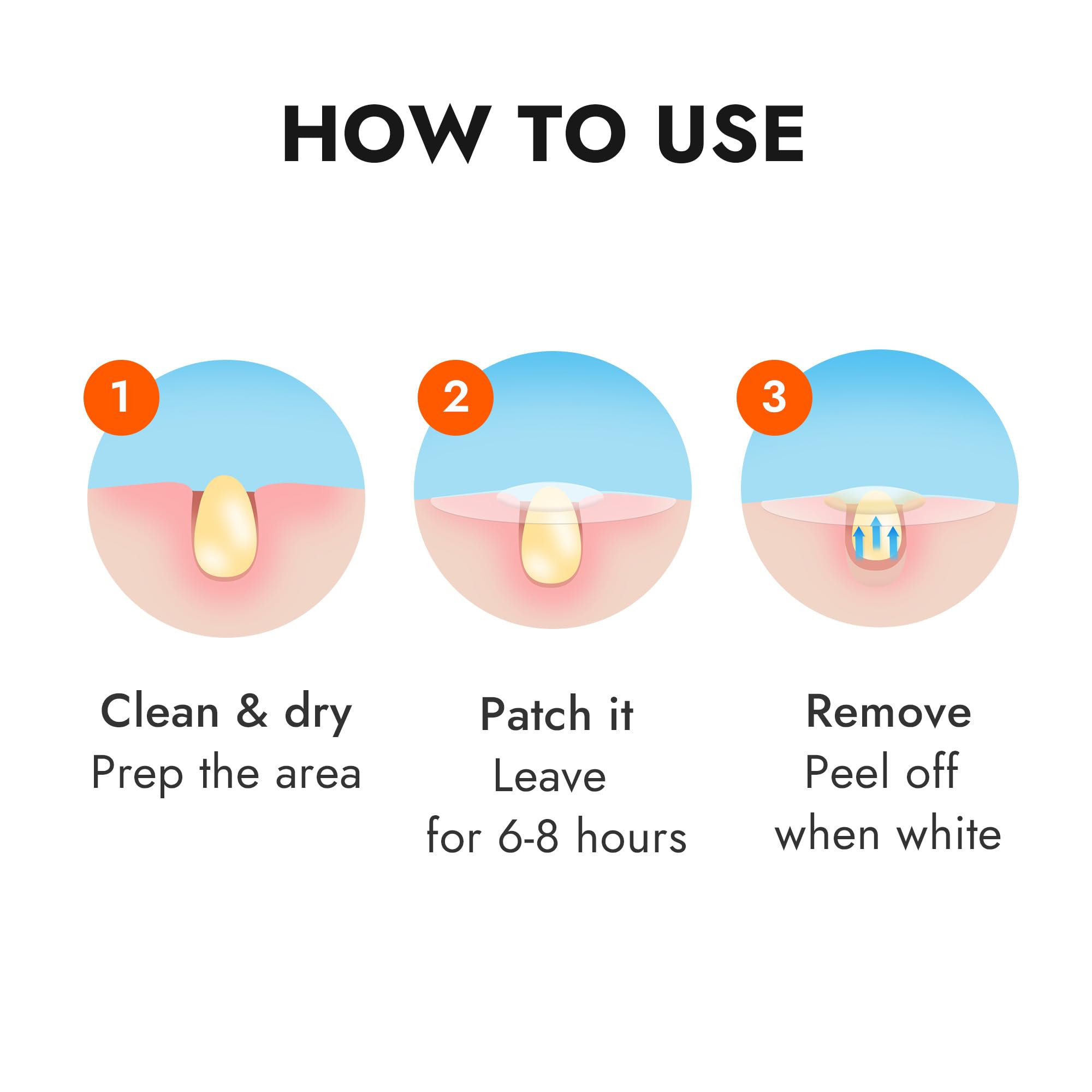 Epielle Over-Zit Nose Patches - Hydrocolloid Acne Treatment for Clear Skin | 10 Count Pimple and Blemish Patches for Nose | Perfect for Overnight Spot Treatment and Easter Gifts
