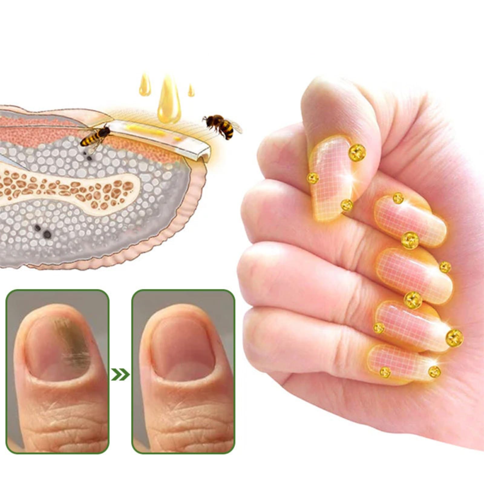 Bee Venom Nail Strengthening Serum - Repair & Growth Treatment for Thin, Brittle & Damaged Nails - Natural Nail Polish Base Coat - Perfect for Weak Nails & Nail Care Routine - Salon Quality At Home