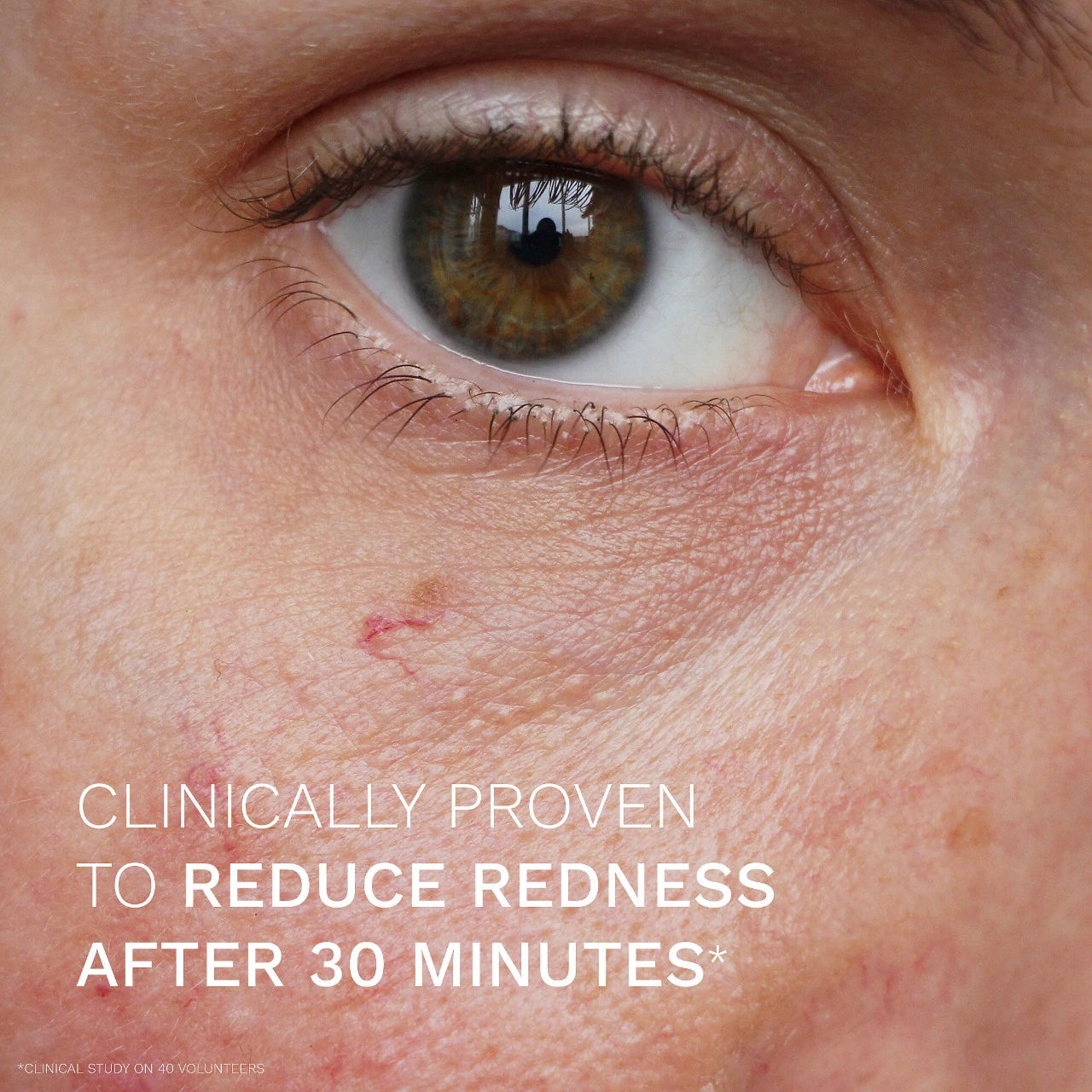 REN Clean Skincare Evercalm™ Redness Relief Serum 30ml - Soothing Facial Treatment for Sensitive Skin | Reduce Redness & Calm Irritation | Perfect for Rosacea & Post-Procedure Care