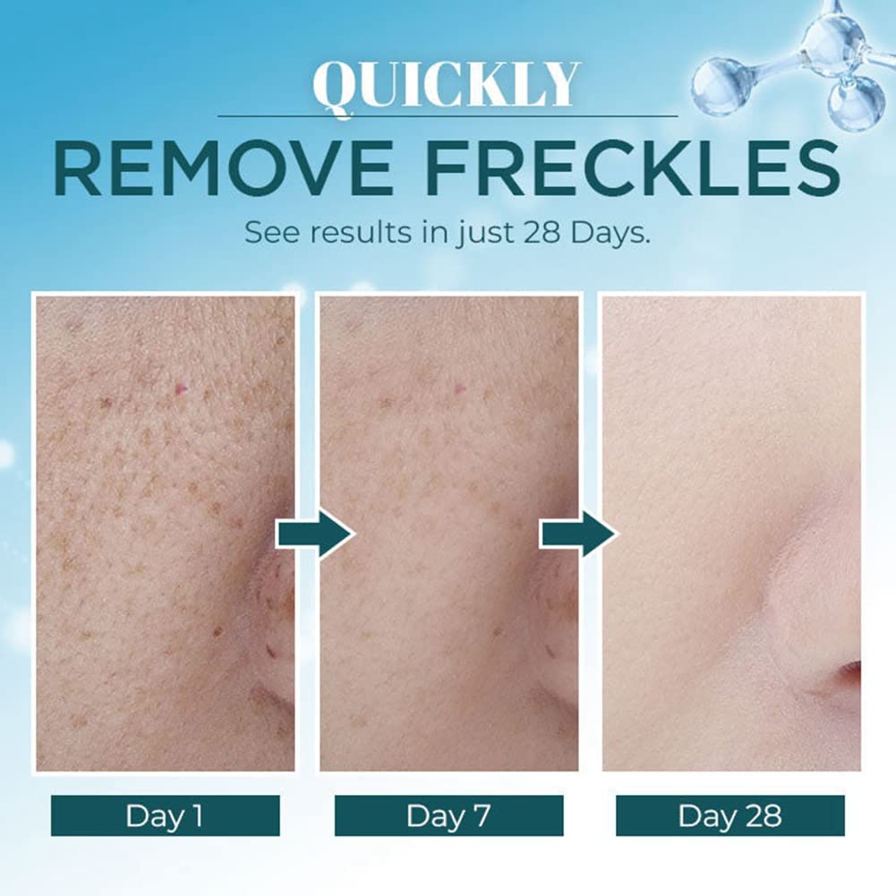 Dark Spot Corrector for Face & Body - Natural Pigmentation Treatment with Cruelty-Free Ingredients | Brightening Serum for Women (30g) | Perfect for Daily Skincare Routine & Hyperpigmentation Care