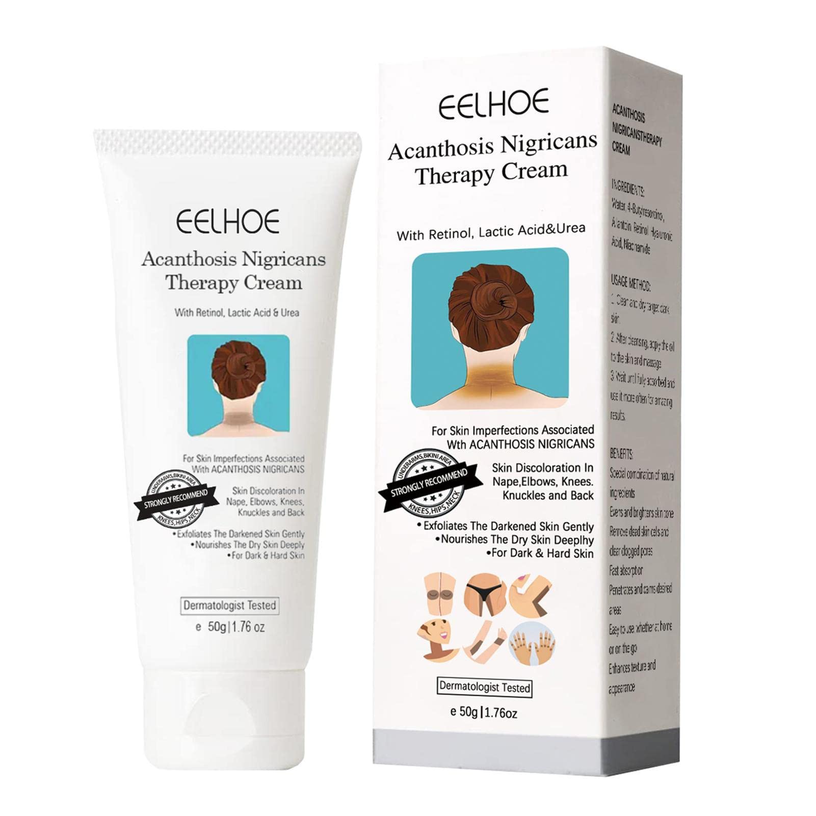 Nigrifree Acanthosis Nigricans Treatment Cream with Lactic Acid & Retinol - Dark Spot Corrector for Face and Body | Skin Lightening Cream for Hyperpigmentation, Neck & Underarms