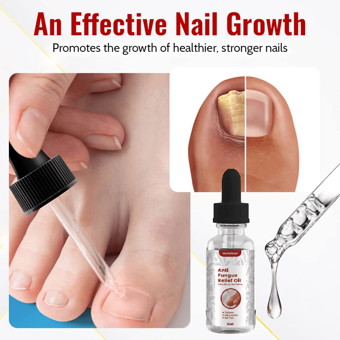 2PCS Japanese NailRenew Rapid Relief Oil - Nail Growth & Strengthener Serum for Fingernails & Toenails - 10ml Nail Treatment & Repair Solution - Perfect for Dry, Damaged Nails & Cuticle Care at Home or Salon