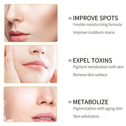 Anti-Aging Face Cream with Skin Care Acids - Dark Spot Corrector & Melanin Reducer for Freckle Removal & Whitening (10g) - Brightening Treatment for Hyperpigmentation & Even Skin Tone | Day & Night Moisturizer for Youthful Glow