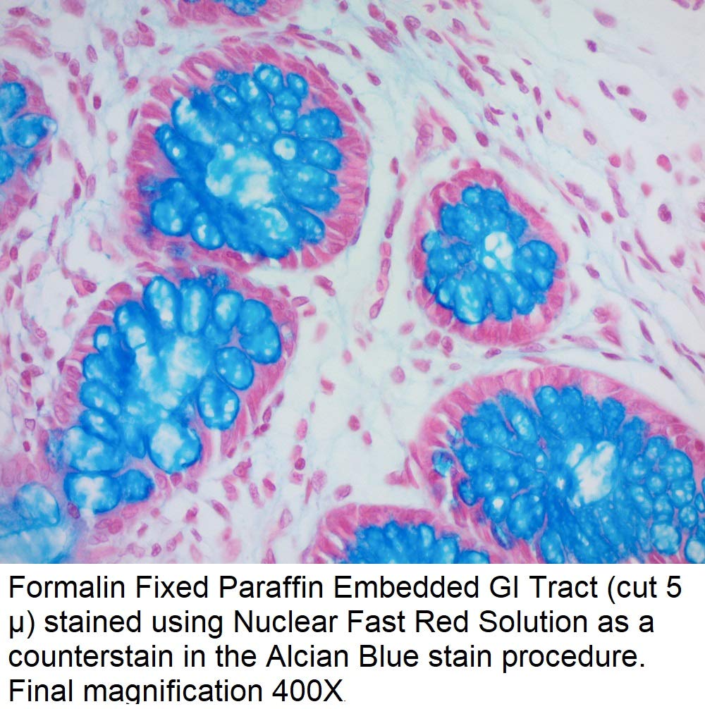 Nuclear Fast Red Solution, 1000ml - Histology Stain for Microscopy & Lab Research | Ideal for Tissue Staining & Biological Studies