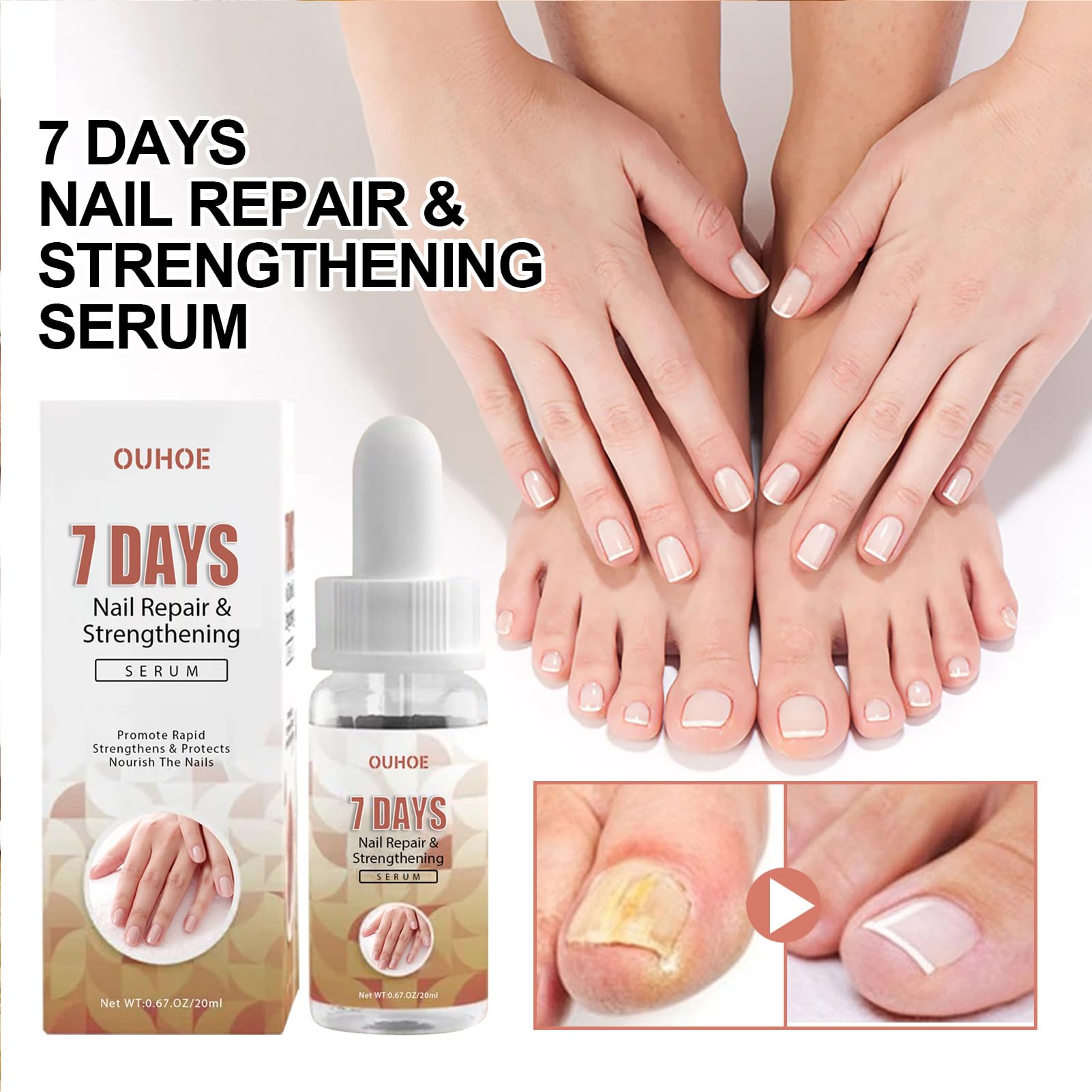 Best Nail Strengthening Cream & Repair Essence - Multi-Purpose Nail Growth Treatment for Damaged, Weak & Brittle Nails - Perfect for Salon, Home Care & Travel
