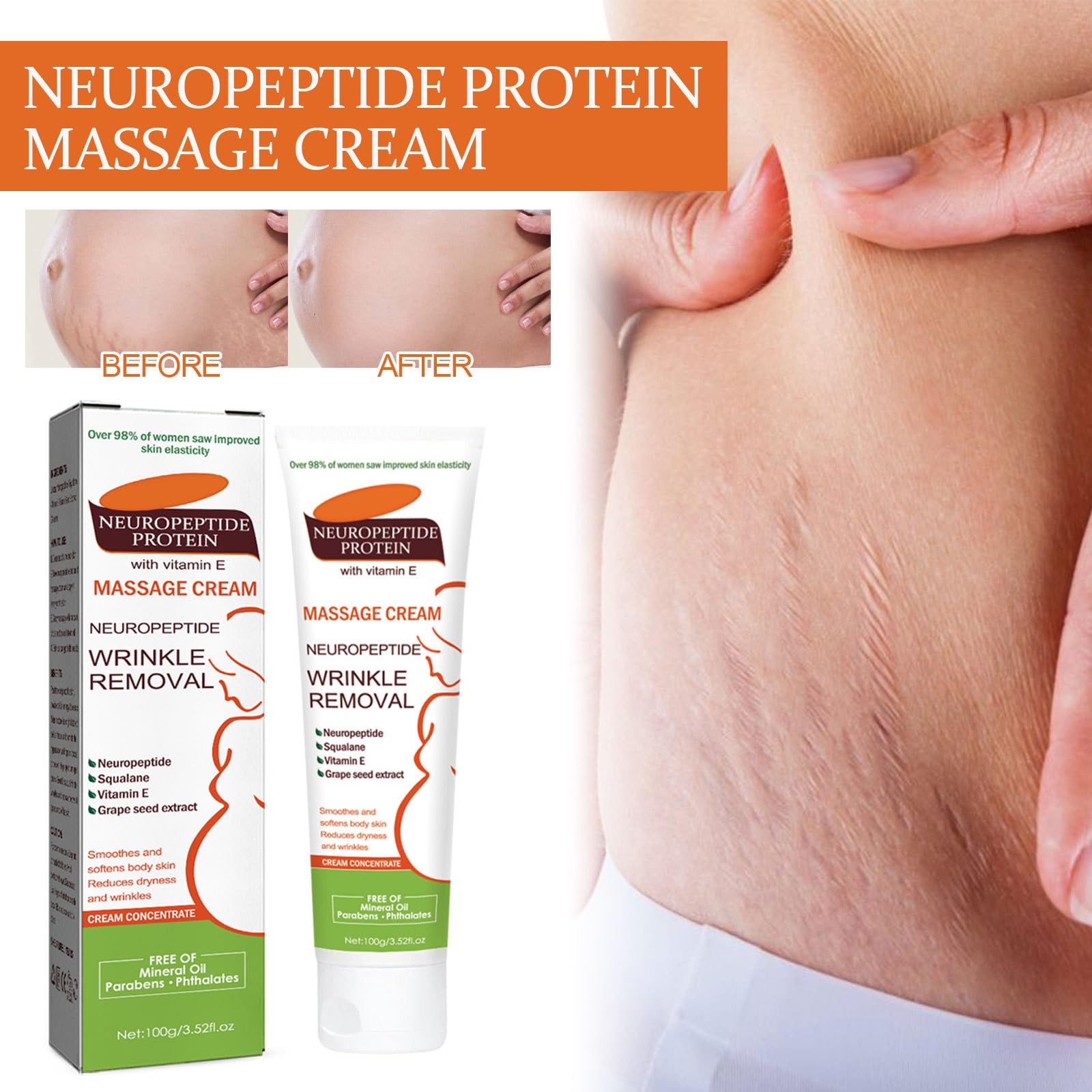 Grgowe Stretch Marks Removal Cream - Anti-Stretch Mark & Scar Repair Treatment for Pregnancy, Weight Loss & Body Care - Fast Absorbing Moisturizing Formula for Belly, Hips & Thighs