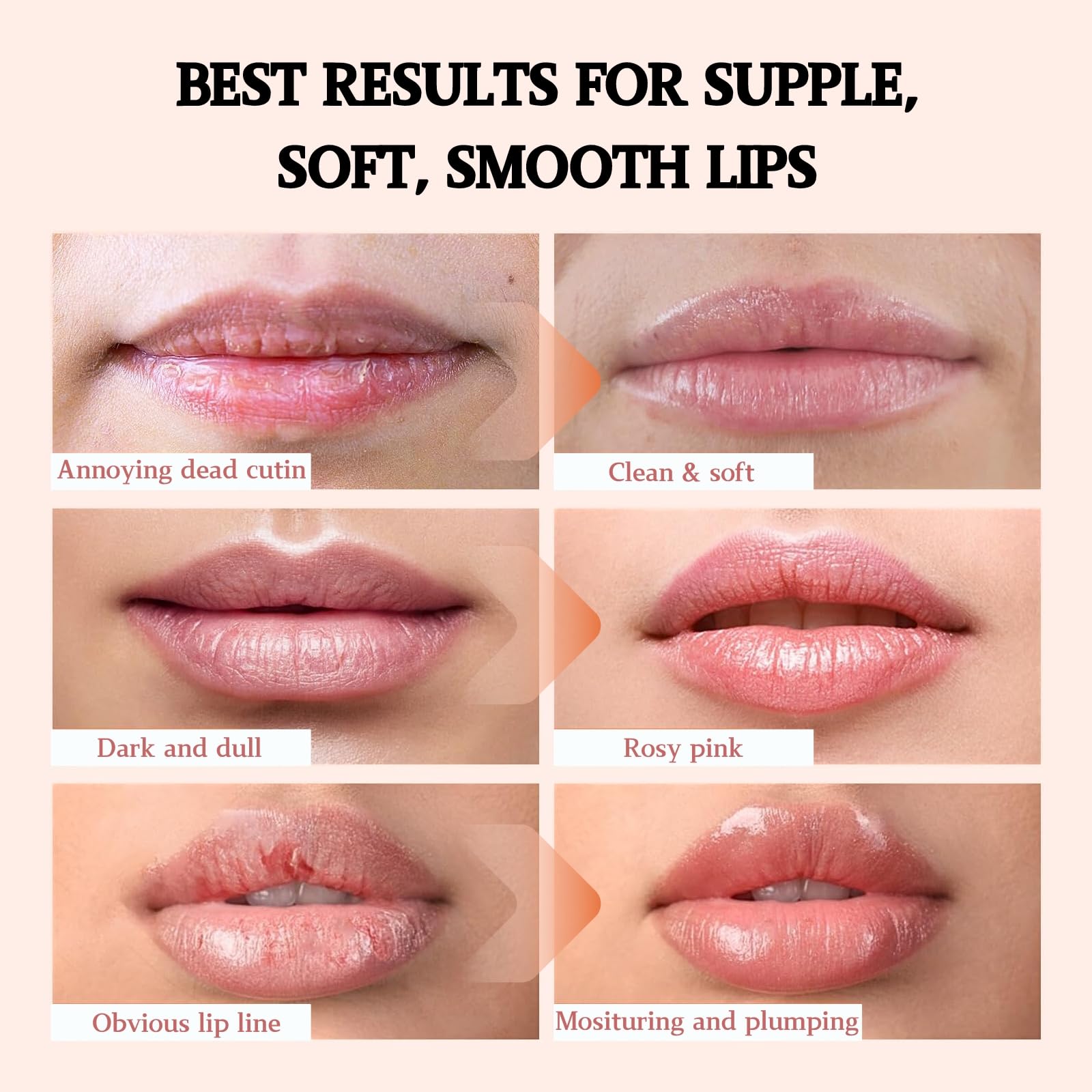 Propolis Lip Scrub & Moisturizing Balm - Natural Beeswax Exfoliator for Dark Lips, Hydrating Treatment for Dry, Chapped & Cracked Lips - Men & Women (Perfect for Winter Care & Daily Lip Nourishment)