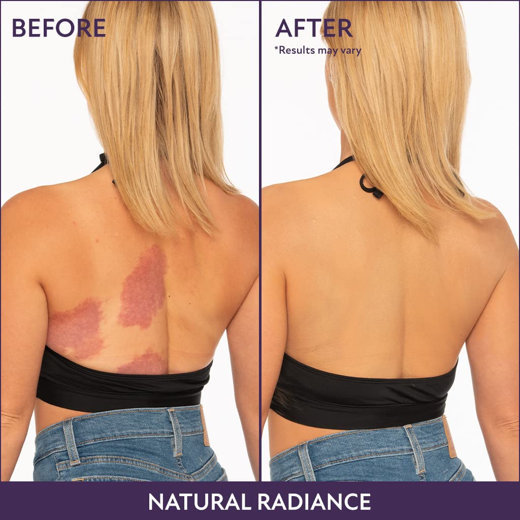 Westmore Beauty Waterproof Body Coverage Perfector - Leg & Body Makeup for Tattoo Cover Up - 7 Oz in Natural Radiance | Long-Lasting Waterproof Formula for Legs, Arms & Body - Perfect for Special Occasions, Weddings & Everyday Wear