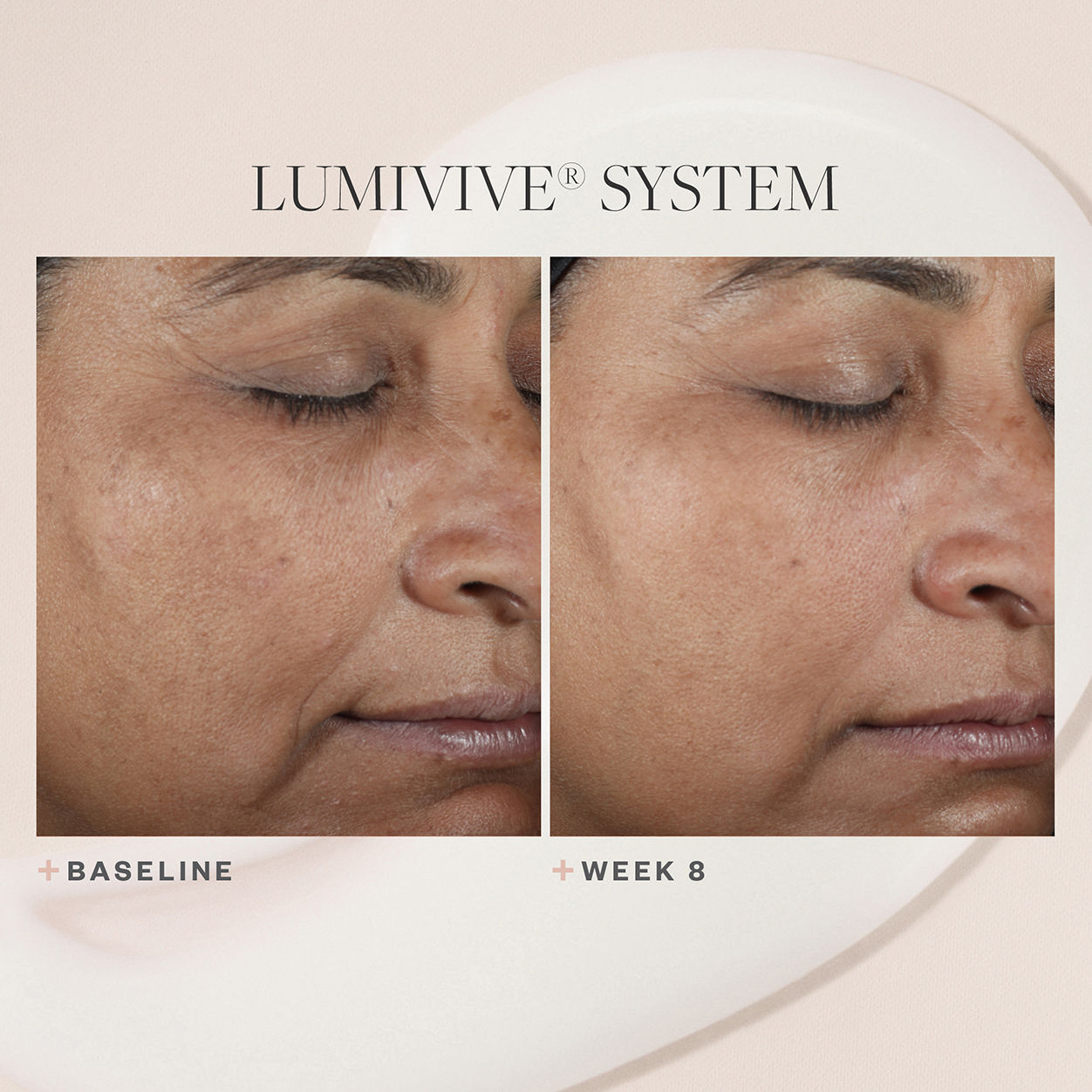 Lumivive System - Day & Night LED Light Therapy for Skin Rejuvenation | Anti-Aging & Acne Treatment | Perfect for Home Spa & Skincare Routine