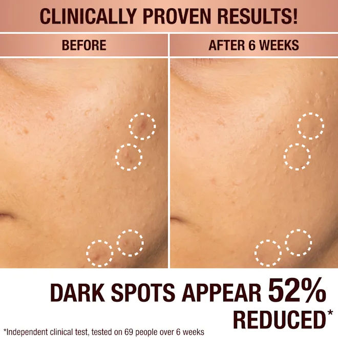 Dark Spot Correcting Radiance Recovery Serum for Face - Brightening & Even Skin Tone Treatment - Perfect for Daily Skincare Routine & Hyperpigmentation Care