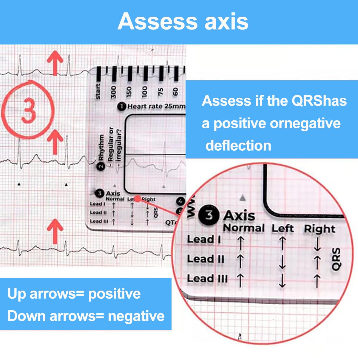 7-Step ECG Ruler for EKG Interpretation - Transparent Caliper Measuring Tool with Portable Assessment Card (2PCS) - Perfect for Medical Students, Nurses & Doctors for Heart Rate Monitoring & ECG Analysis
