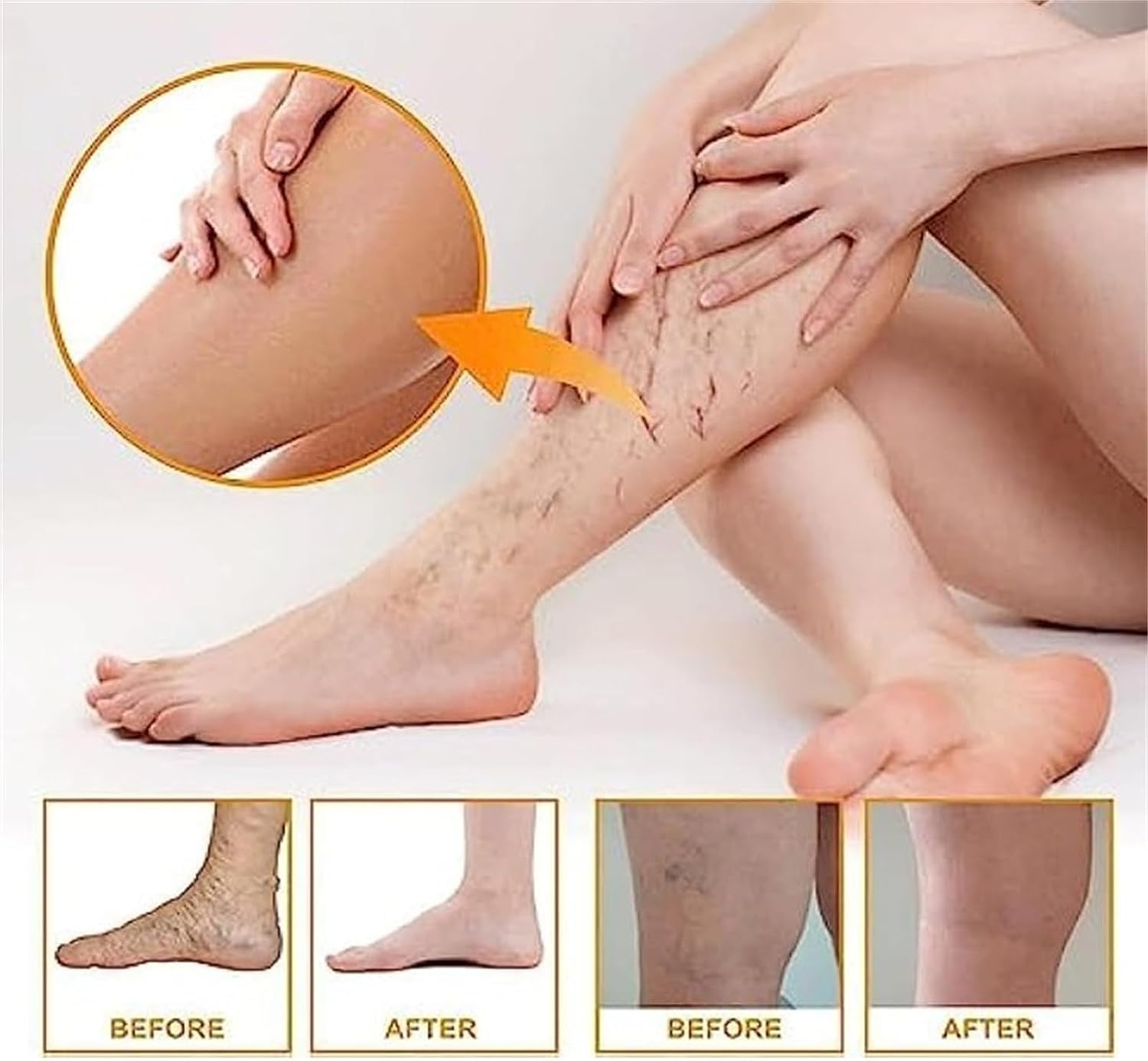 **Marrone Oil for Varicose Veins Relief – Natural Chamomile Essential Oil – Soothes Leg Pain & Improves Circulation – Perfect for Massage & Relaxation (1pc)**