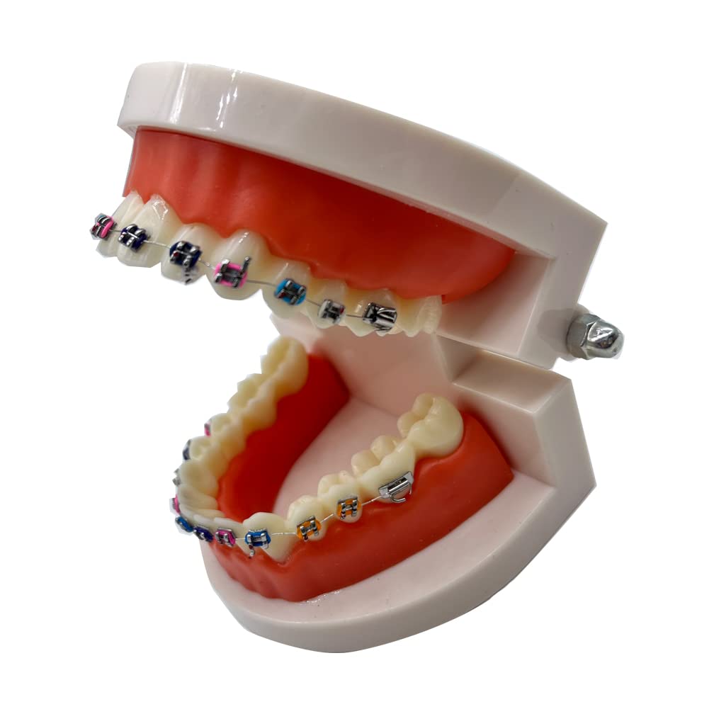 Orthodontic Dental Demonstration Model with Metal Brackets & Arch Wire - Standard Teeth Model for Braces Training & Education - Perfect for Dentists, Students & Orthodontic Practices