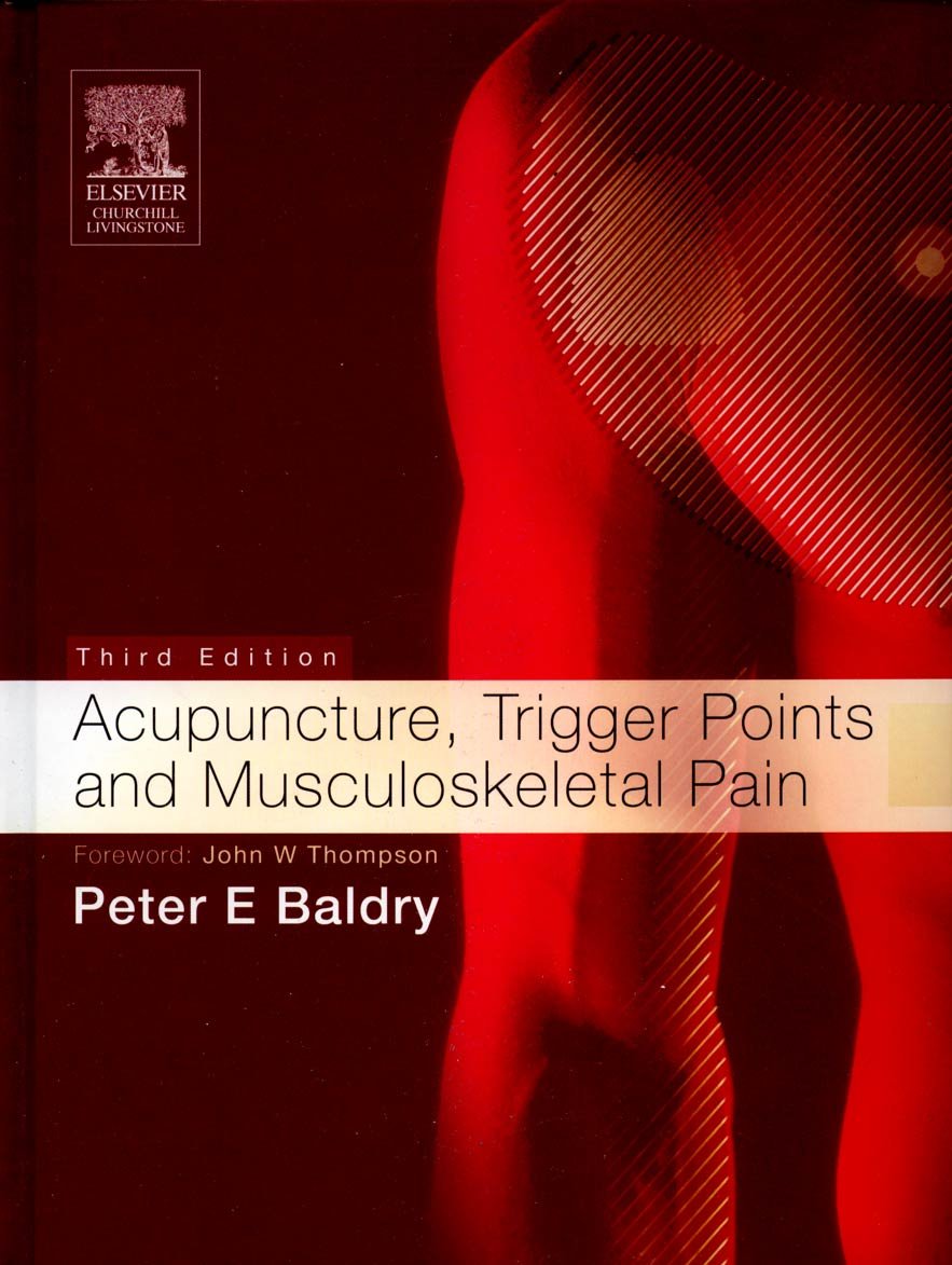 Acupuncture for Trigger Points & Musculoskeletal Pain Relief - Natural Therapy for Chronic Back Pain, Neck Pain & Joint Discomfort - Perfect for Athletes, Office Workers & Seniors