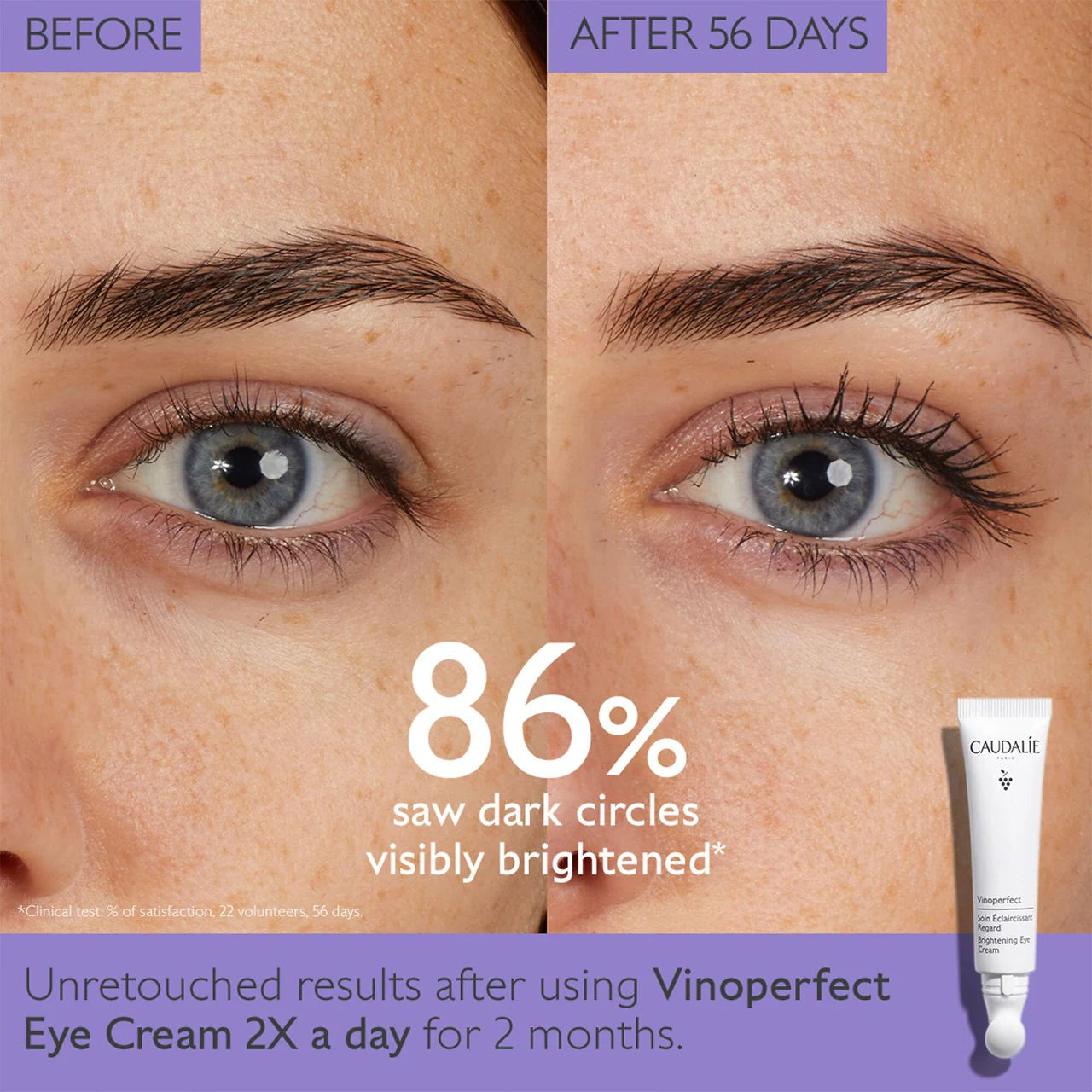 Caudalie Vinoperfect Dark Circle Brightening Eye Cream 15ml - New in Box - Reduce Puffiness & Brighten Under Eyes for Day & Night Use