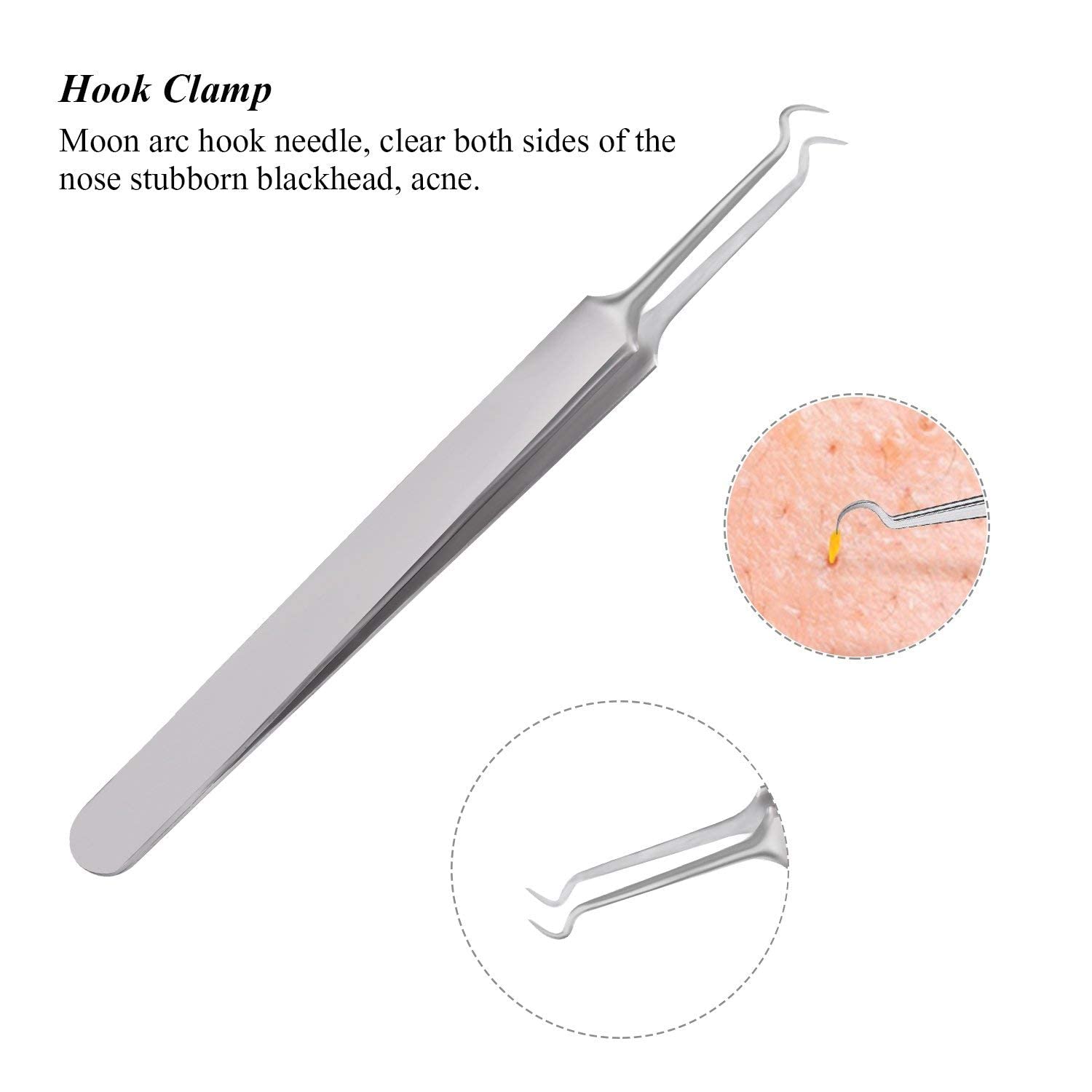 Professional Blackhead & Whitehead Remover Kit - 3 Pcs Stainless Steel Comedone Extractor Tools for Acne & Pimple Popping - Perfect for Facial Skin Care & Blemish Removal at Home