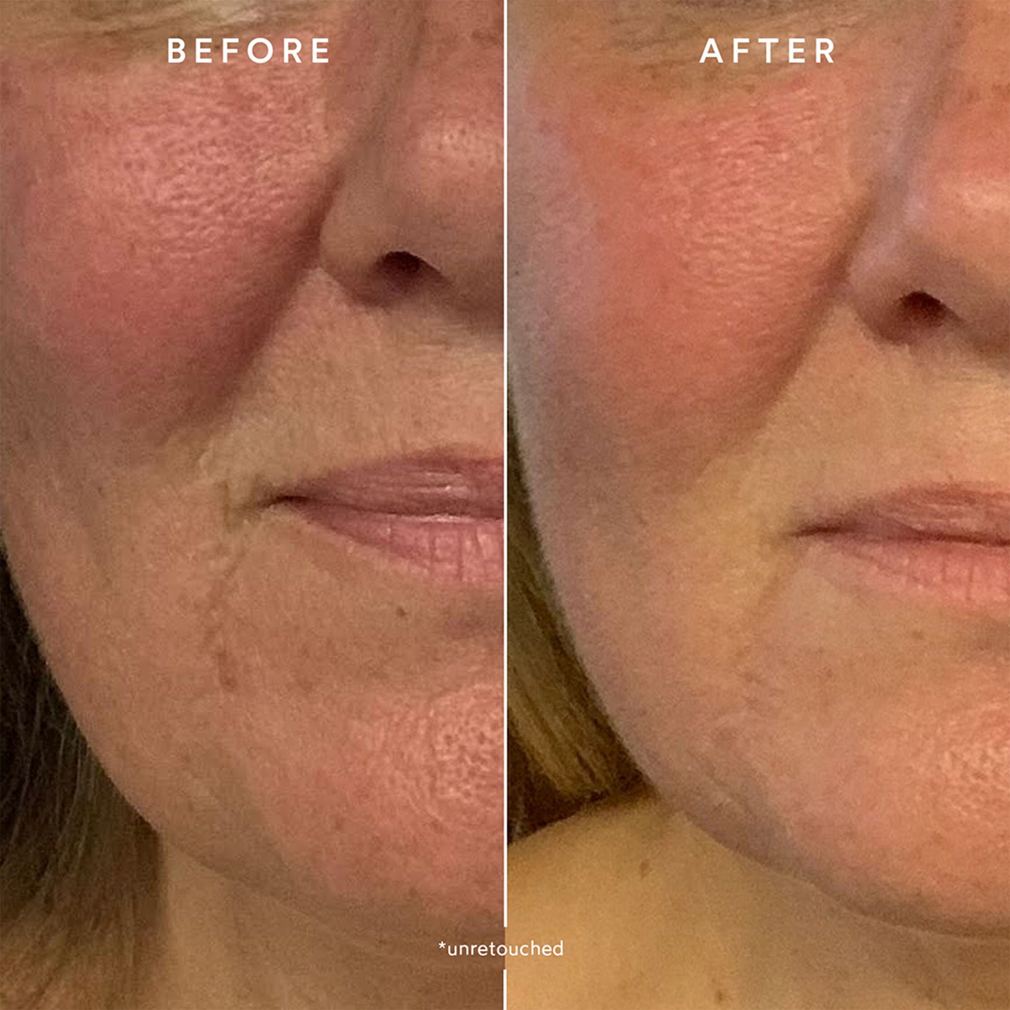 RENEW Repair Nightly Treatment - Anti-Aging Face Cream for Deep Hydration & Skin Repair | Perfect for Nighttime Skincare Routine