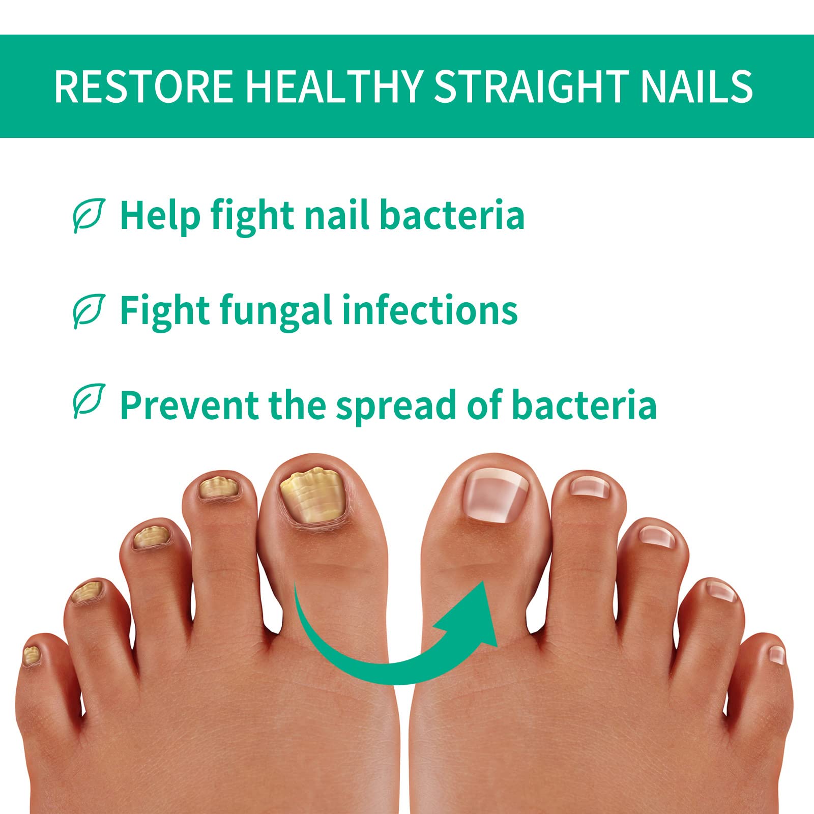 Nail Repair Essence Treatment - Strengthening & Nourishing Liquid for Damaged & Discolored Nails (3 Pack) | Perfect for Pedicures, Manicures & At-Home Nail Care