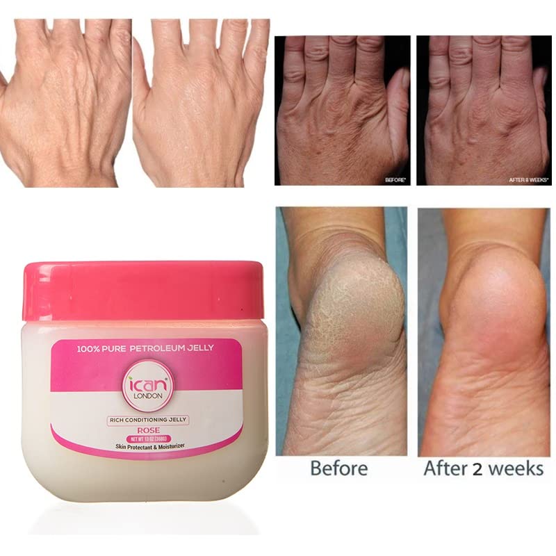 ICAN LONDON ROSE 100% Pure Petroleum Jelly 13oz (368g) - Moisturizing Skin Care for Dry Lips, Hands & Face | Multi-Purpose Healing Ointment for Babies & Adults