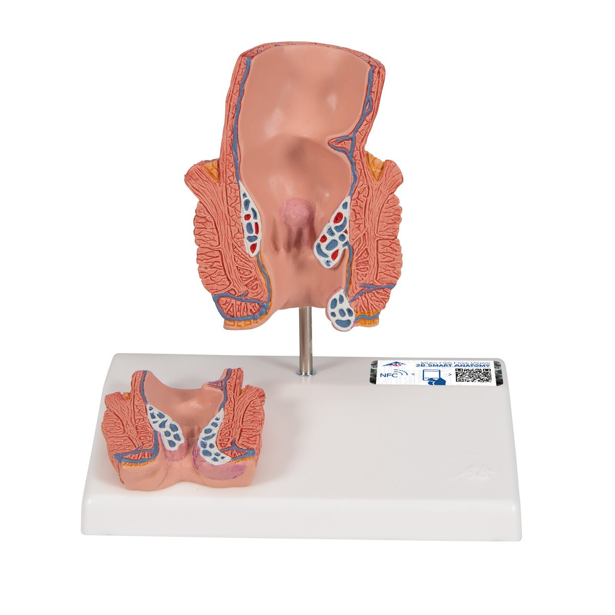 Premium Hemorrhoid Anatomy Model for Medical Training & Patient Education – Ideal for Doctors, Nurses & Healthcare Professionals