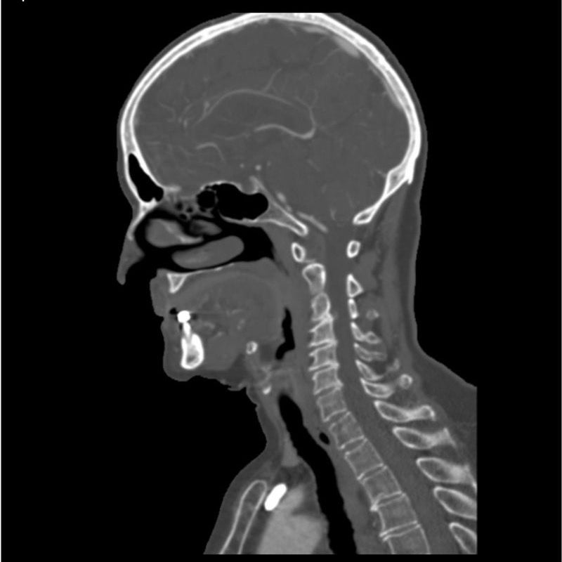 Professional CTA Head and Neck Phantom - High-Quality CT Scan & X-Ray Training Model for Medical Education | Perfect for Radiology Students, Technicians & Clinical Practice