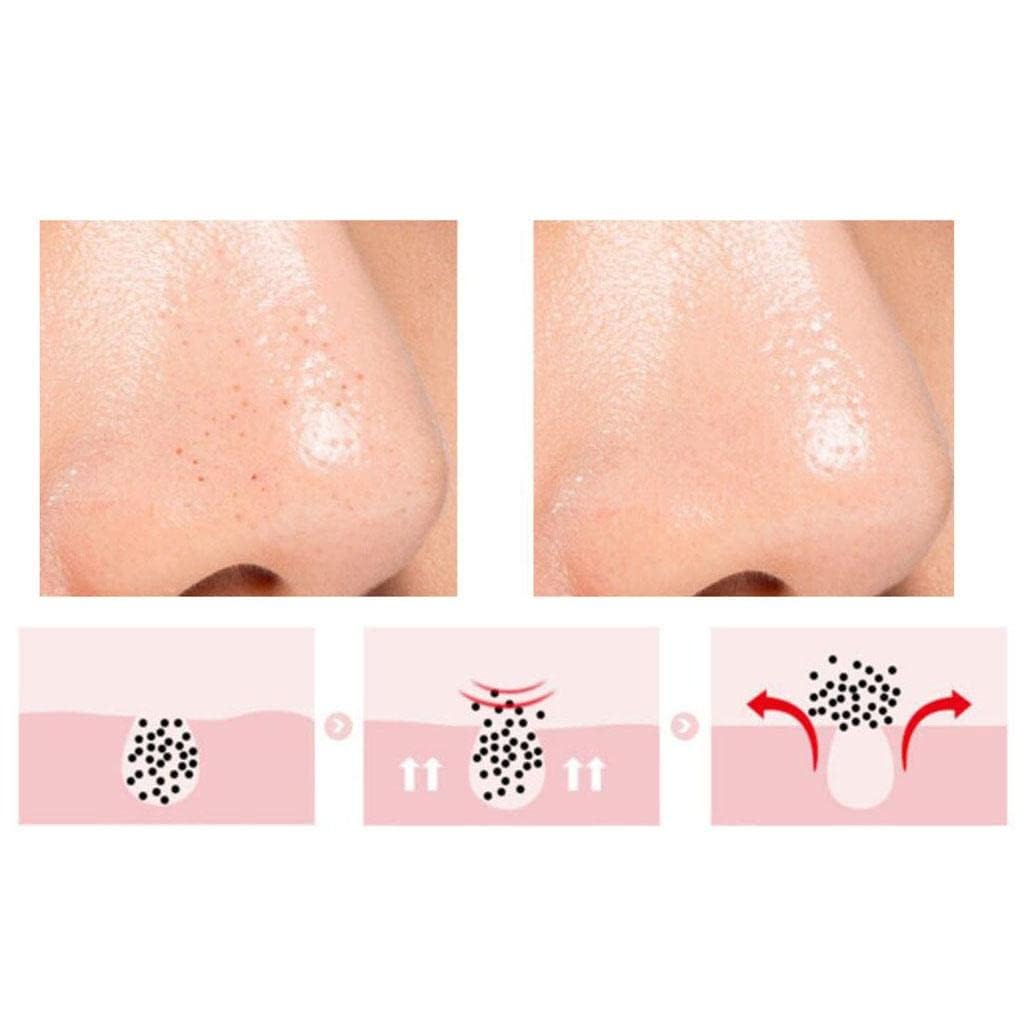 NYAMAH SALES Silicone Facial Scrubber - Blackhead Remover, Lip & Nose Exfoliator, Deep Cleansing Massage Brush for Face & Skin Care - 1pc Multicolor - Perfect for Daily Skincare Routine & Spa Treatments